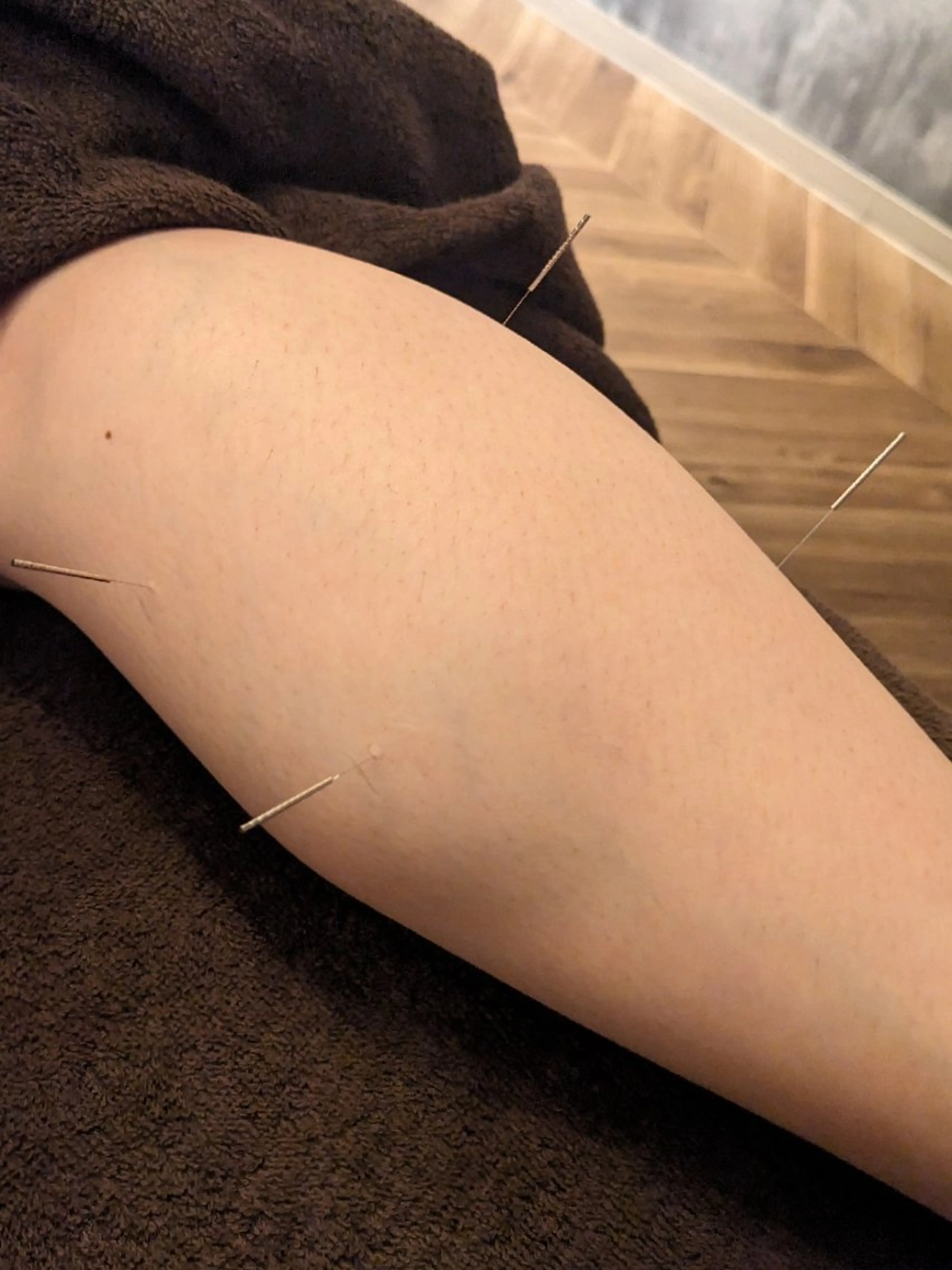 乃々鍼灸・整体院　表参道所属・乃々鍼灸整体院　植木 　【美容鍼/整体】のエステ・リラクイメージ