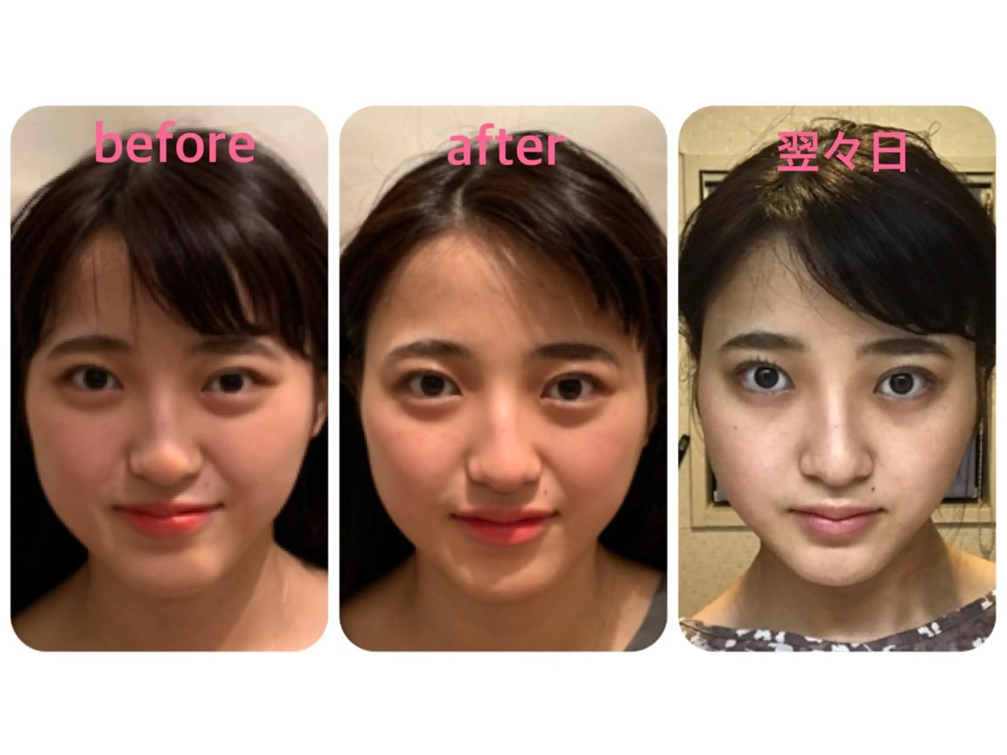 美小顔フェイシャル【新規限定】の写真