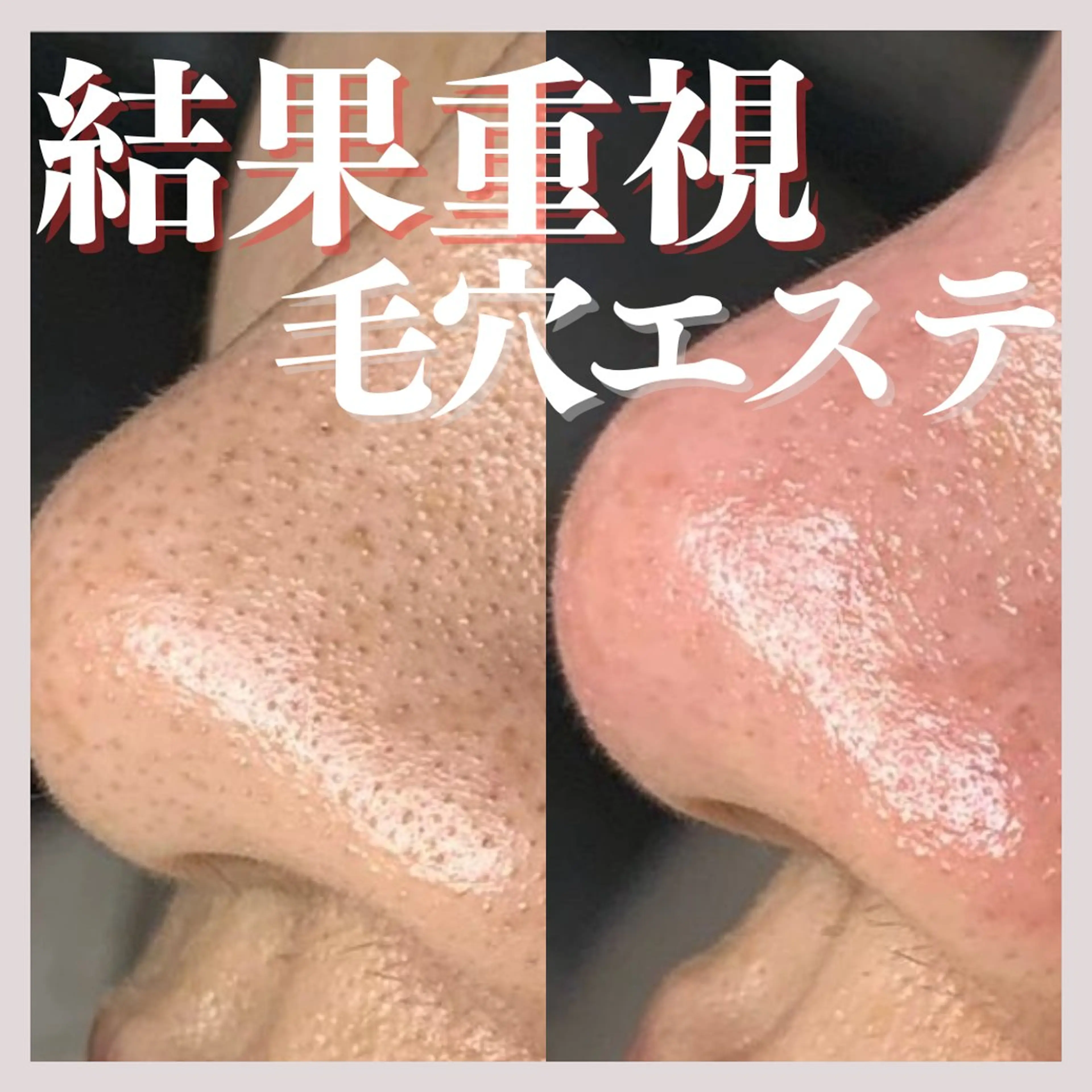 エステ salon MUSUBUのエステ・リラクイメージ