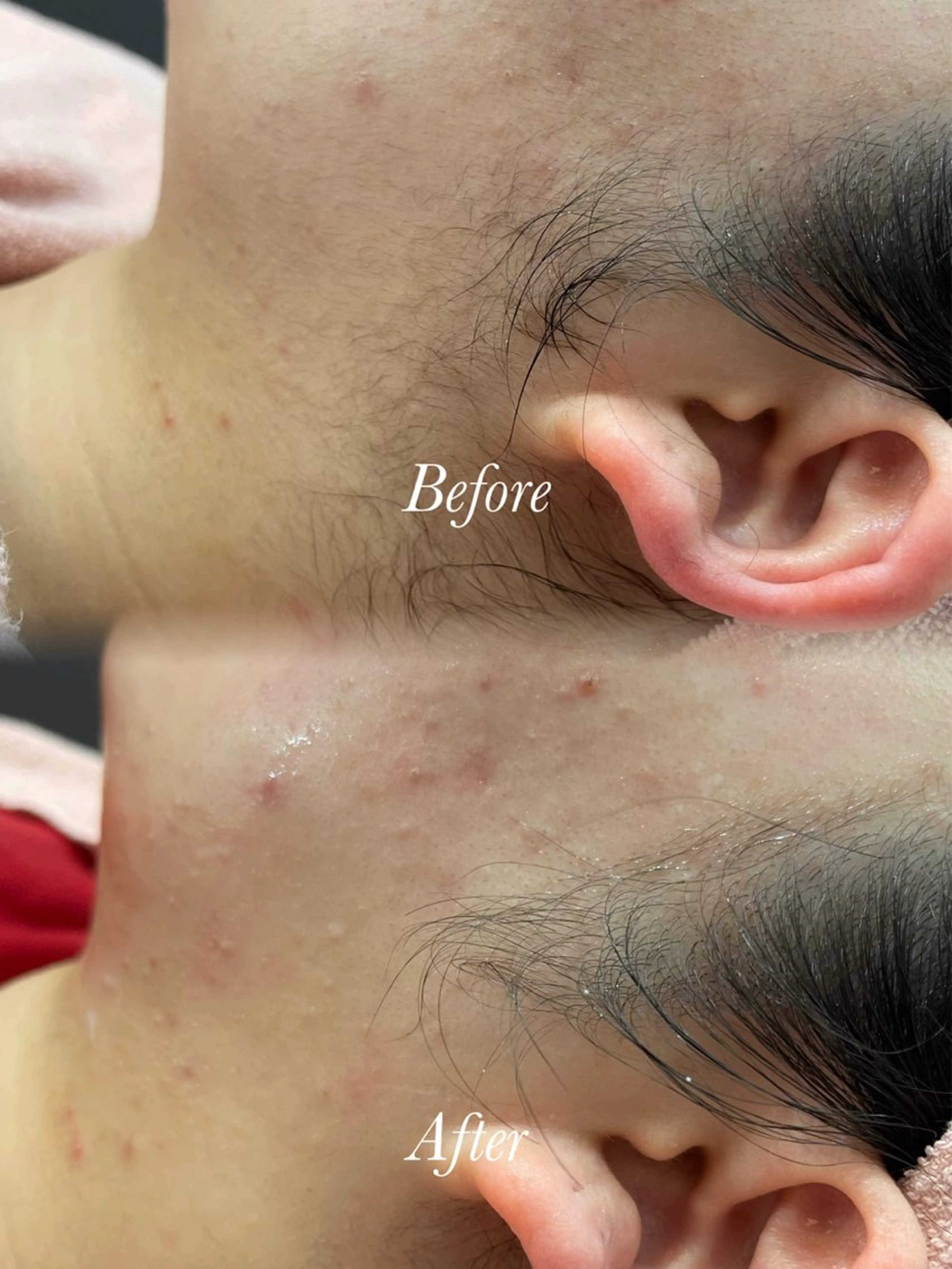 🫧美しい素肌へ🫧 今成柚乃のその他イメージ