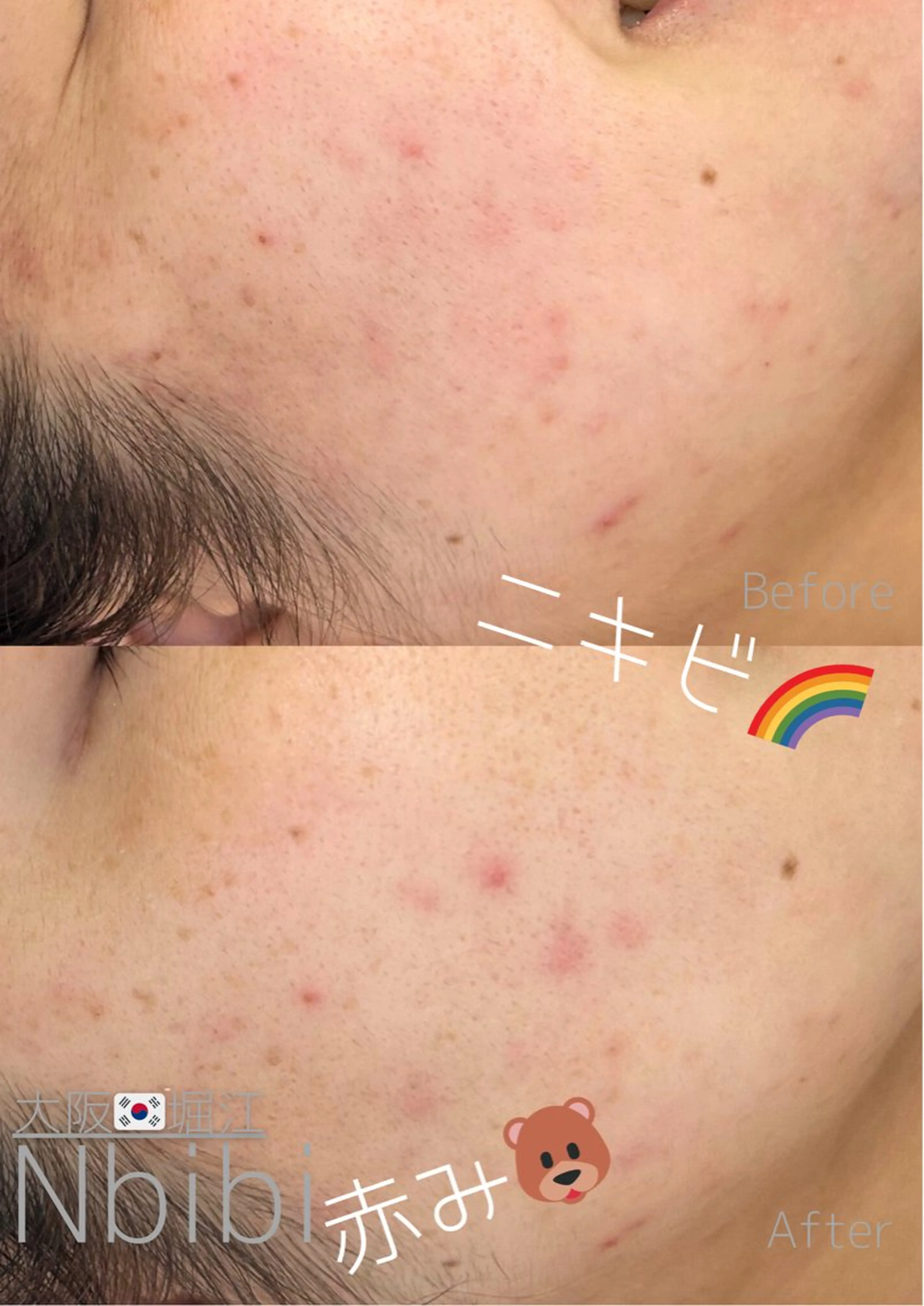 エステ 韓国🇰🇷価格 サロン_Nbibiのエステ・リラクイメージ