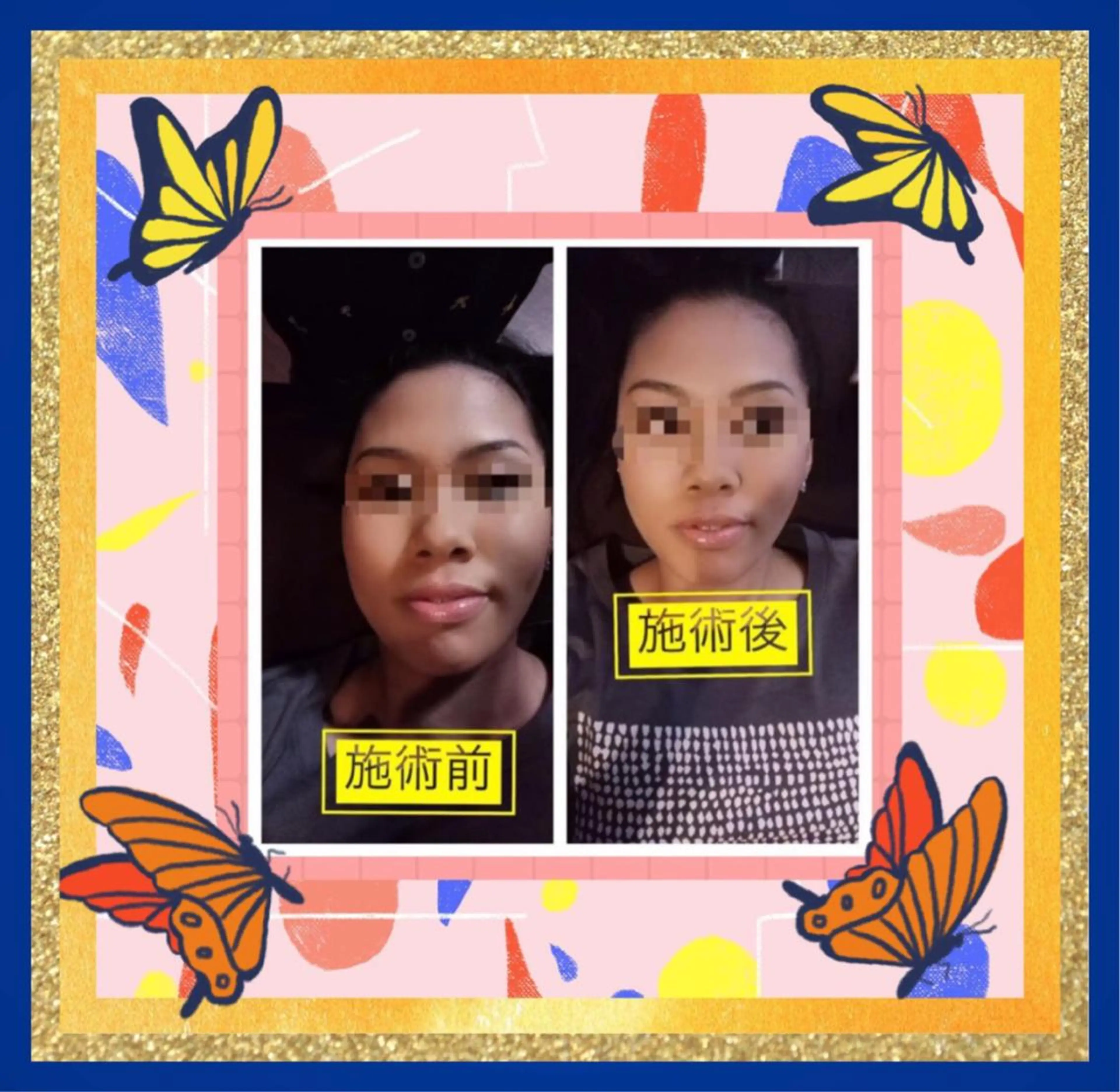 美容整体サロンMikie所属・小沼 美希恵のその他イメージ