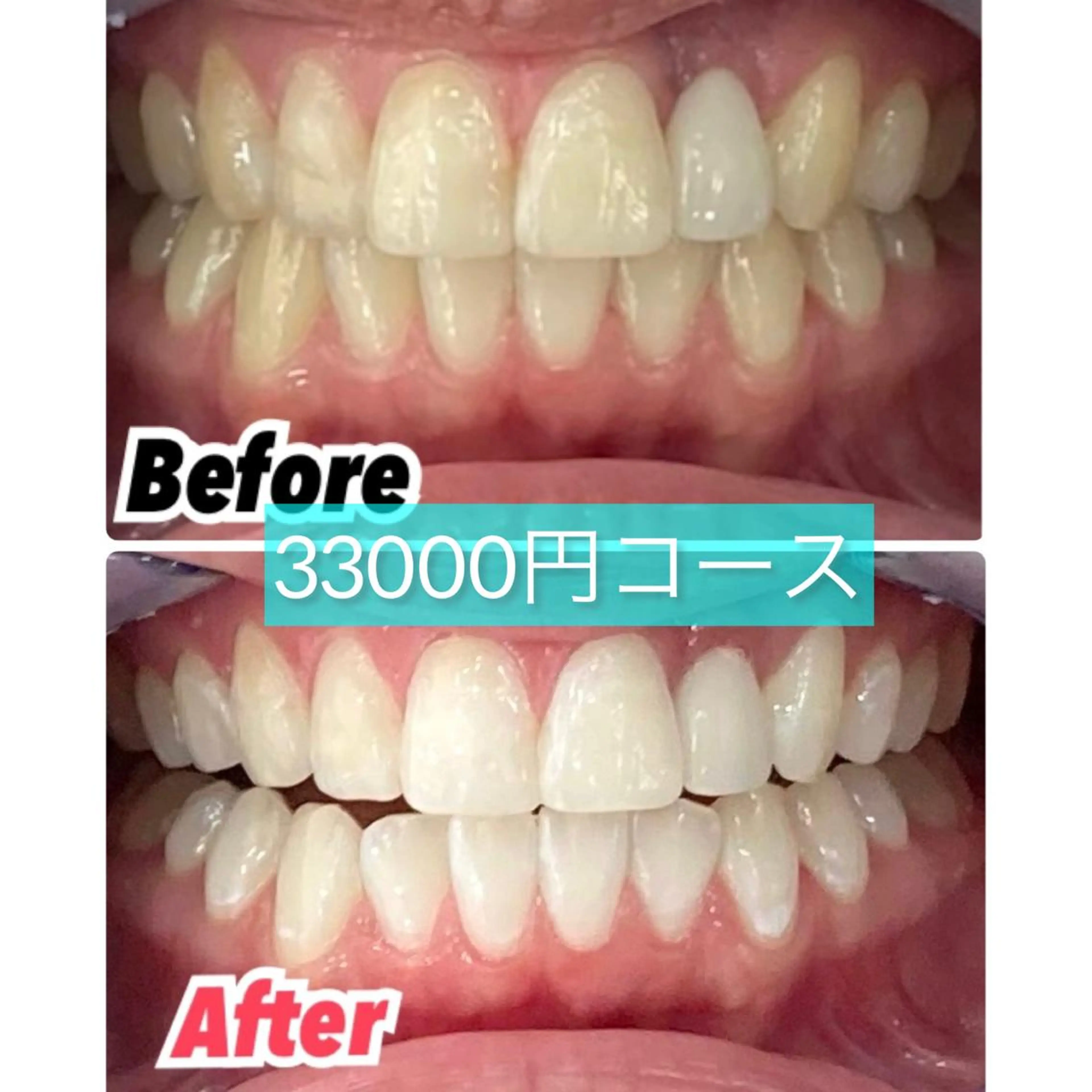 セミロング カラー パーマ ヘアアレンジ メンズ キッズ ネイル マツエク・マツパ アイブロウ プラチナムビューティー柏所属・【歯科提携】柏ホワイ トニングスタイルのその他イメージ