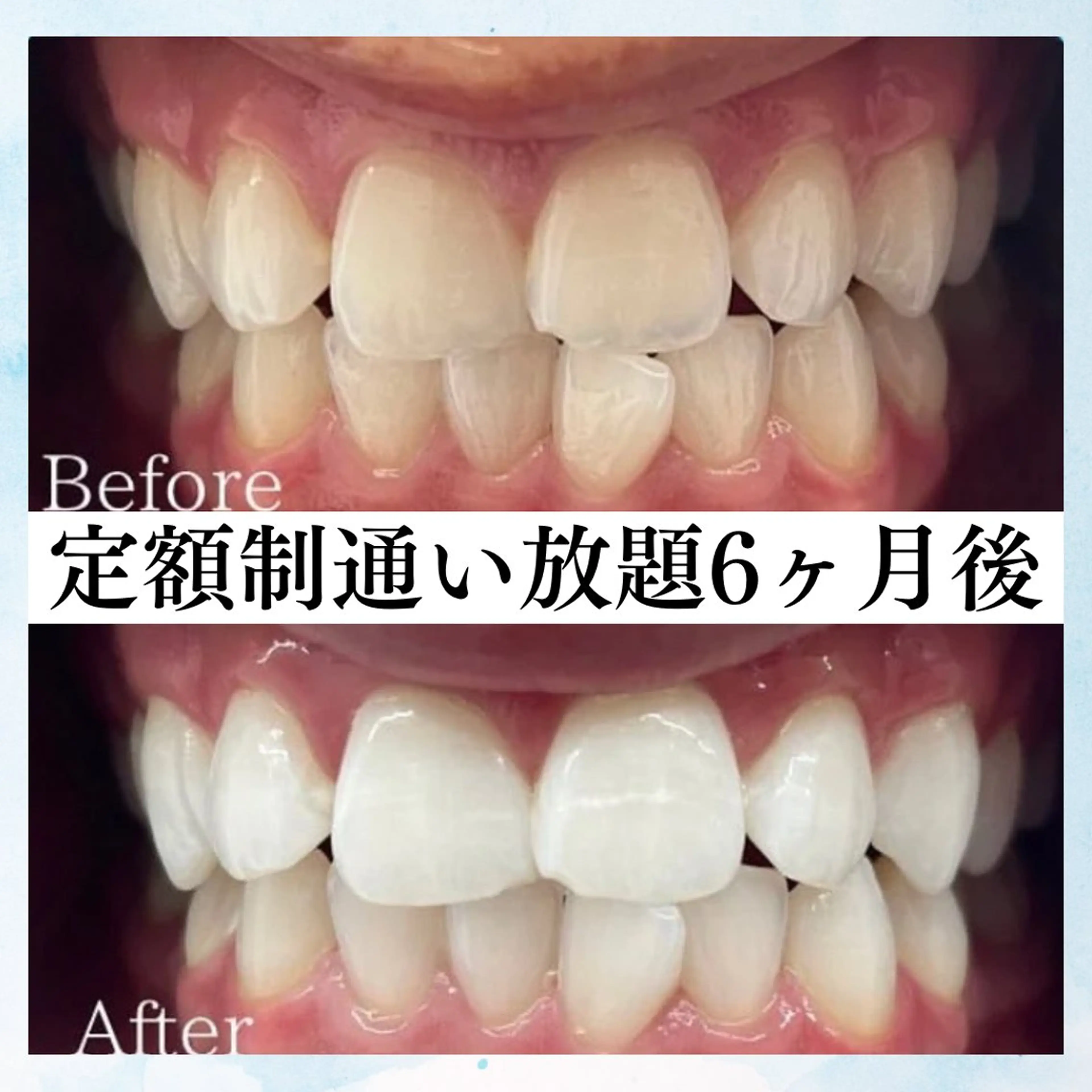 メンズ ホワイトニング専門店 WHITE天神店のエステ・リラクイメージ