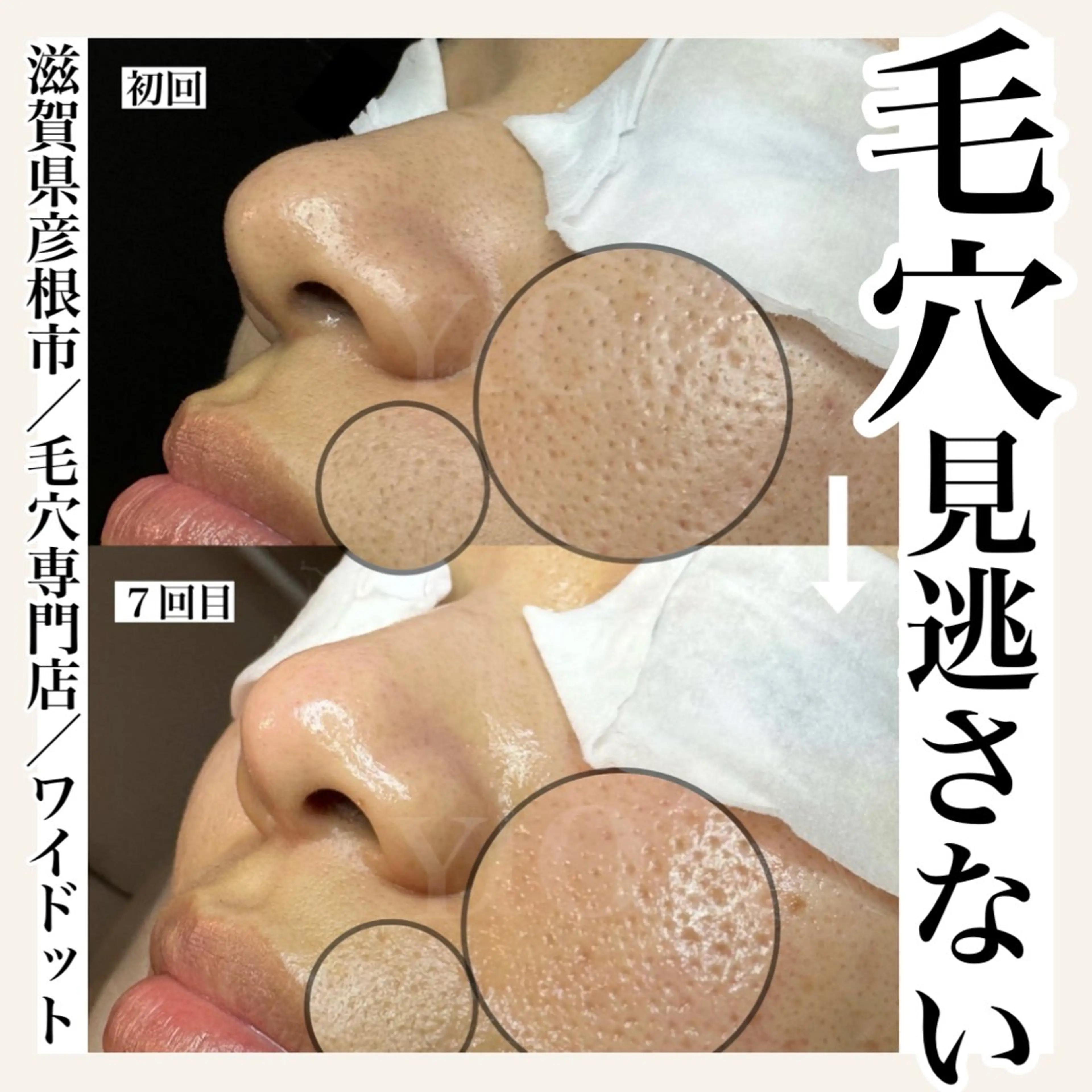 エステ Ydot. 池内 友架のエステ・リラクイメージ