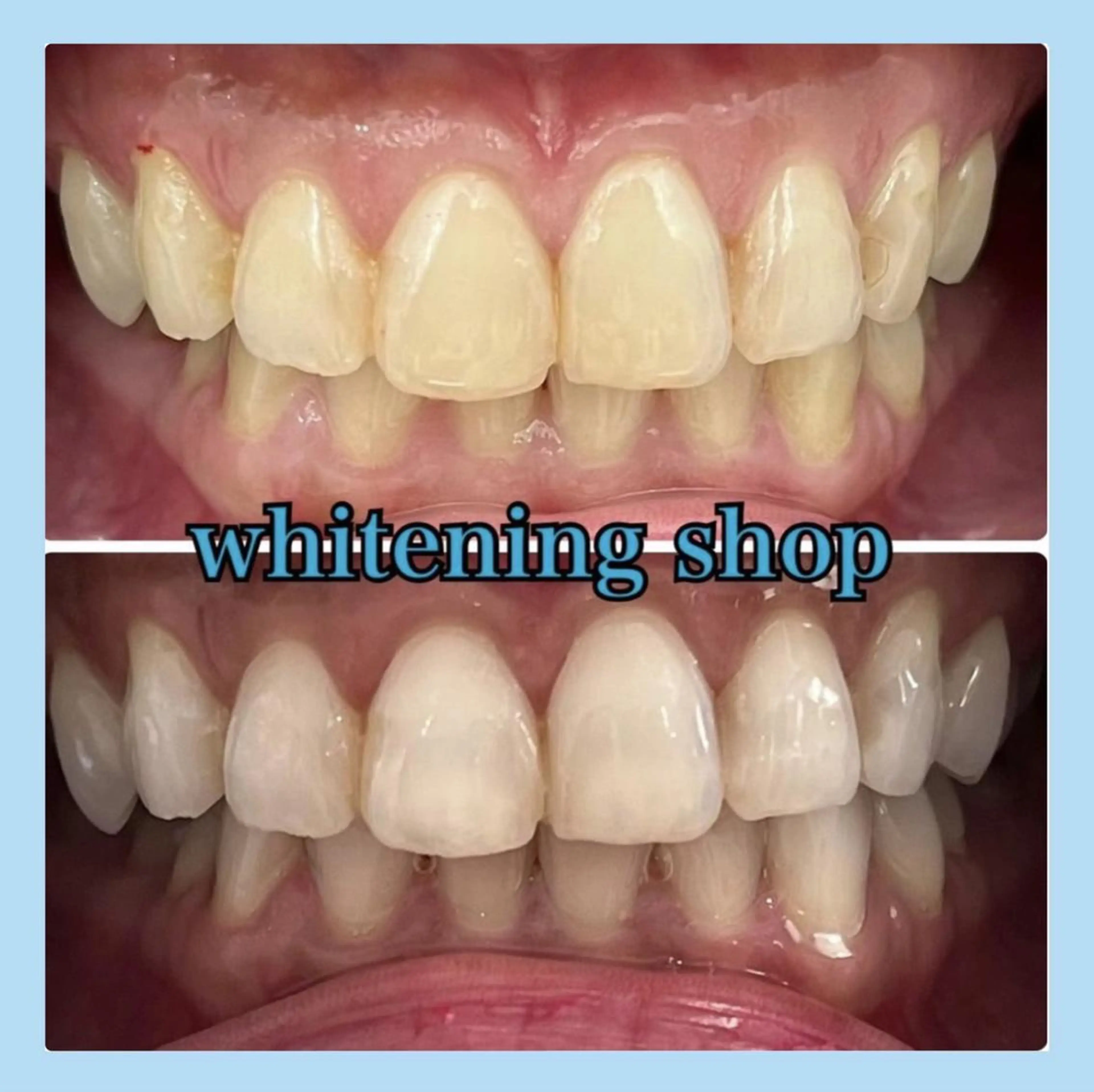 ホワイトニング ショップ千葉店のその他イメージ