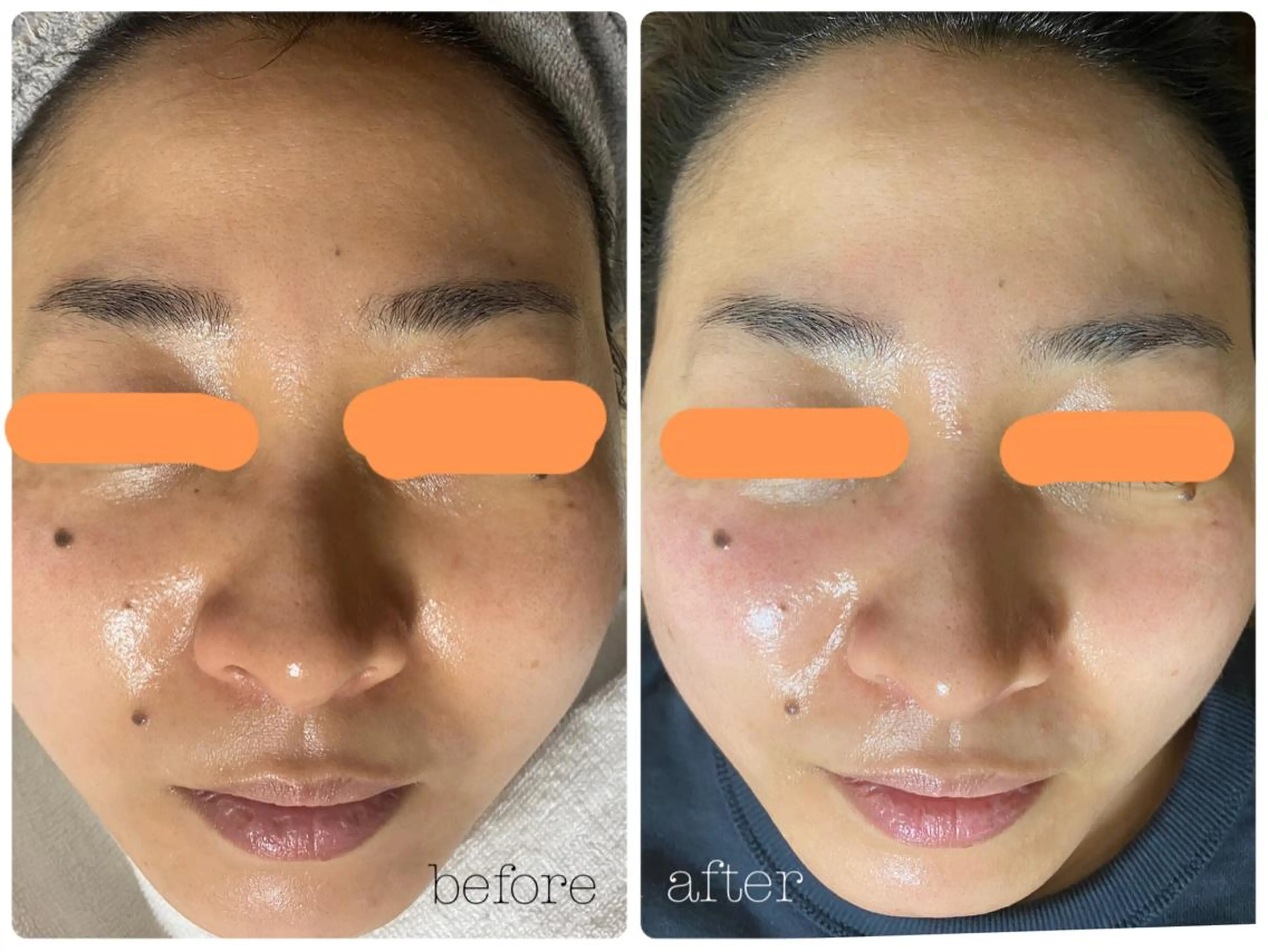 ビューティマッサージングトリートメント✨期間限定極上パック付き☺️の写真