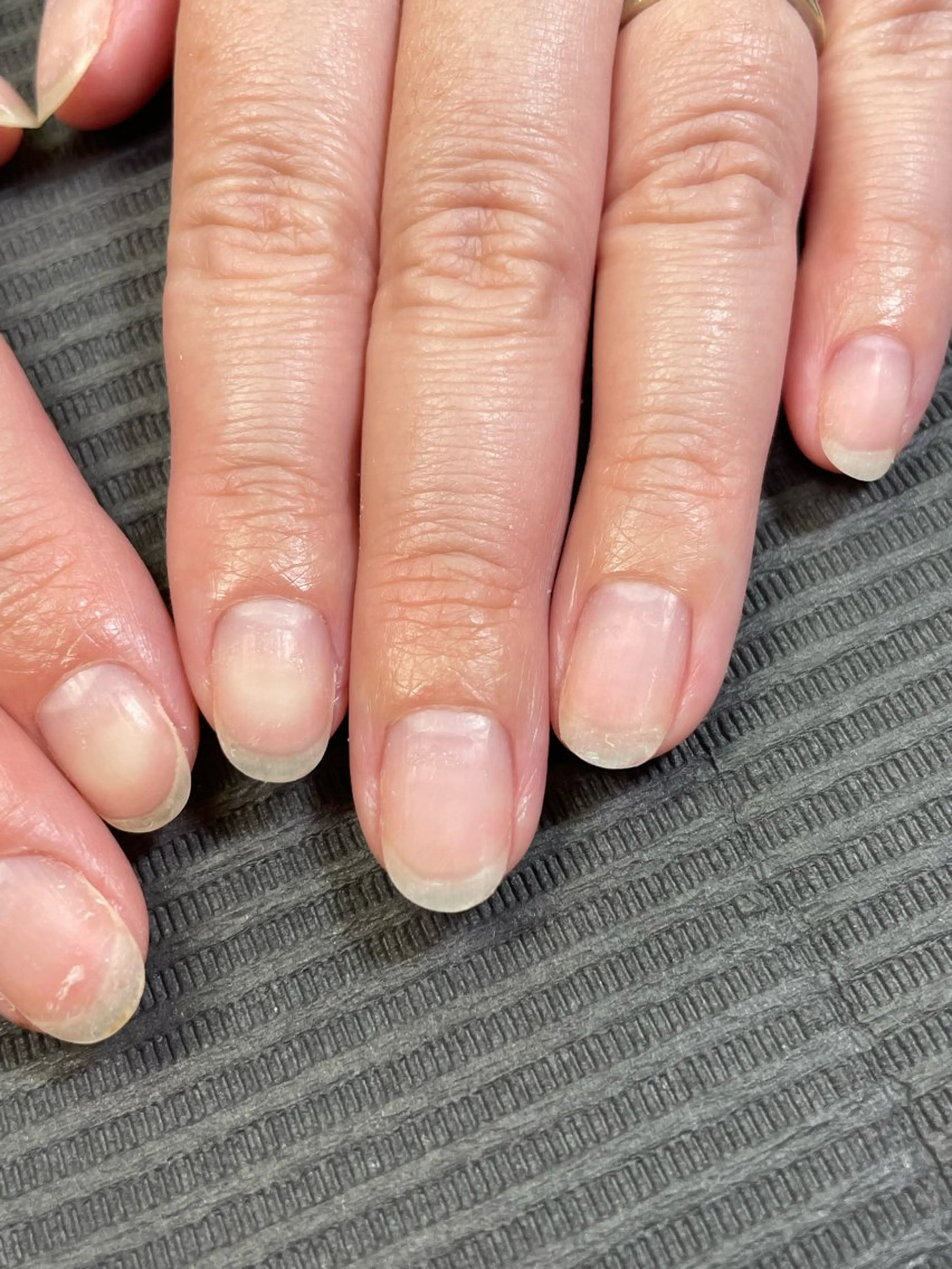 爪活「爪を育てるネイルケア」体験モニターの写真