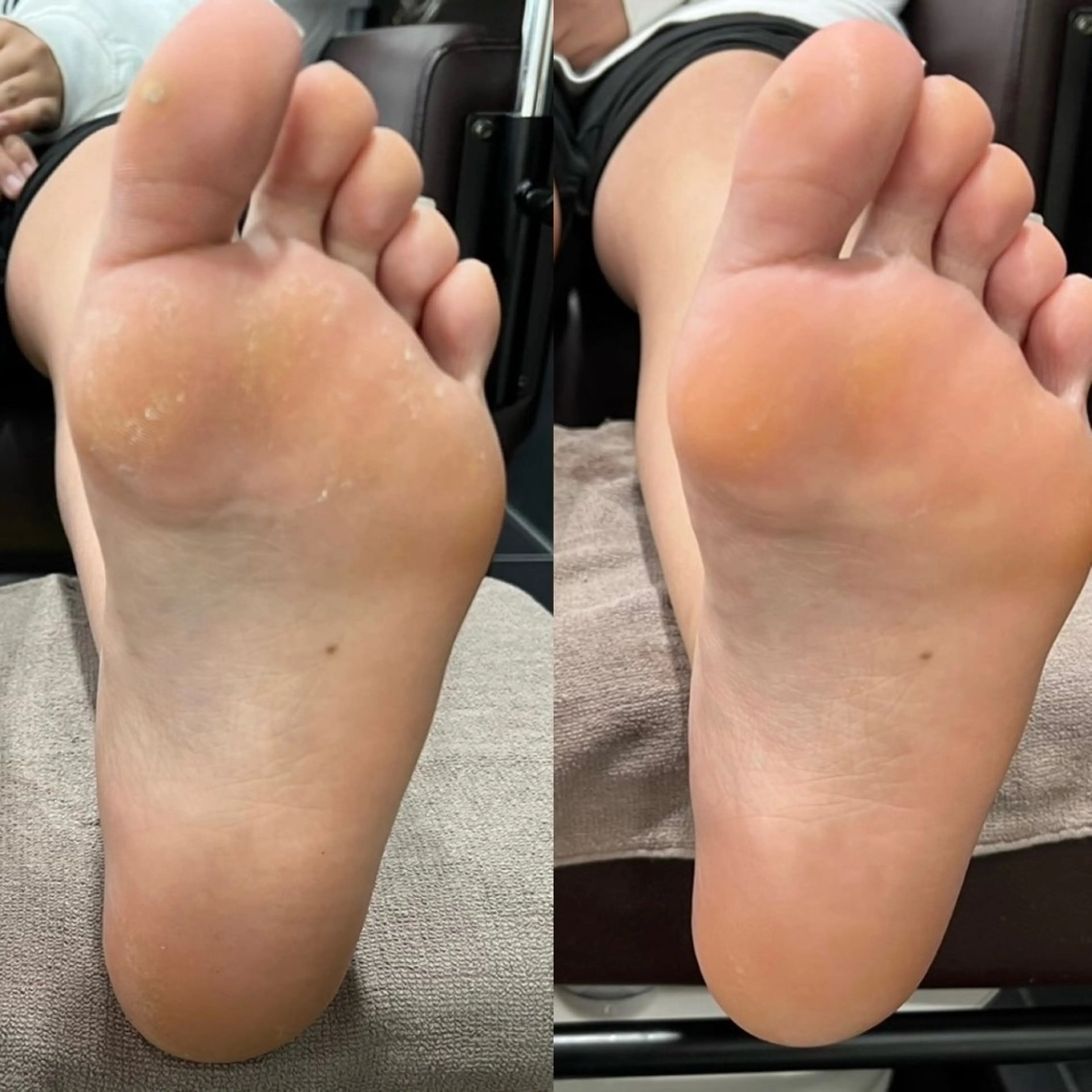 foot special menu✨〘foot nail 持ち込みデザイン＆足裏の角質除去〙の写真