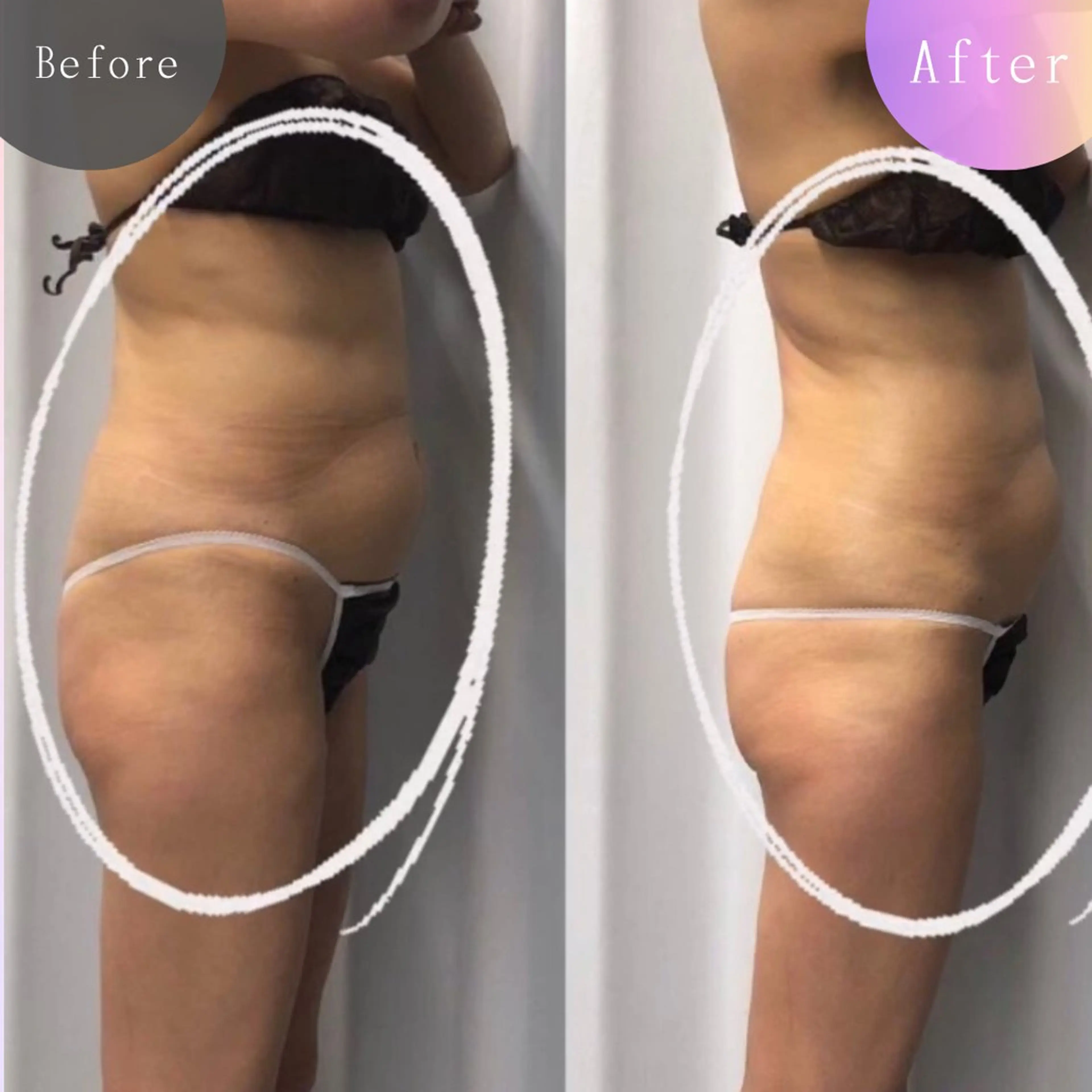 美容整体・塗る漢方・フェイシャルRechica所属・心斎橋痩身 美肌整体サロン💓のエステ・リラクイメージ