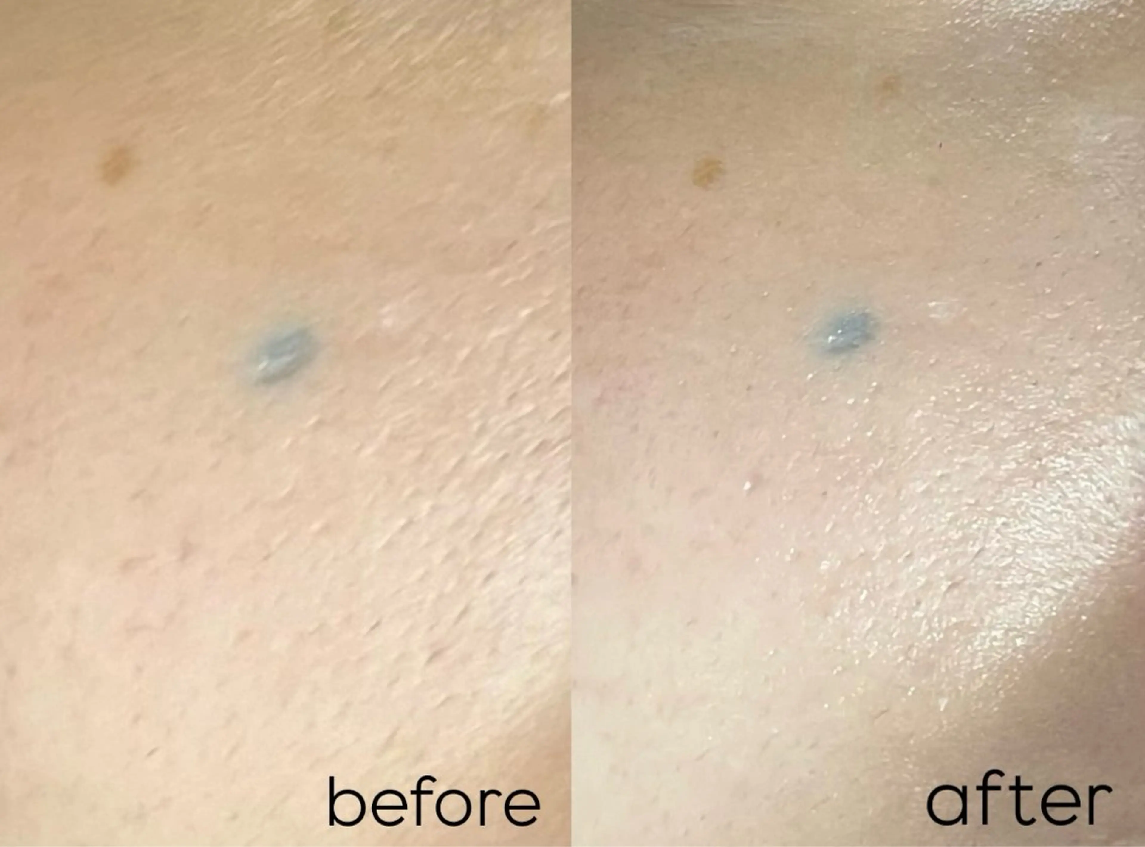 エステ Mr.&Ms.脱毛 NATSUMIのエステ・リラクイメージ