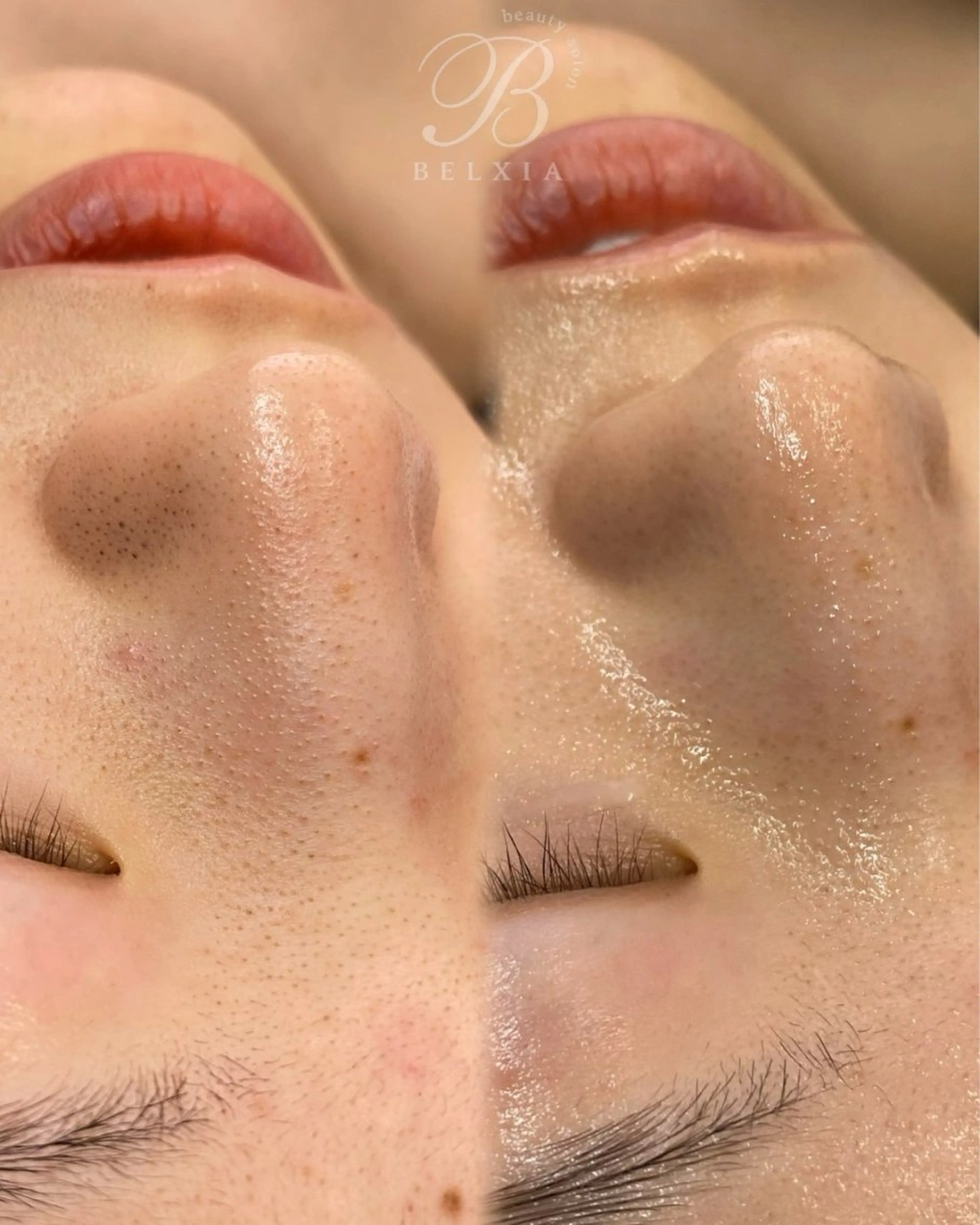 BELXIA所属・井櫻 玲香のエステ・リラクイメージ