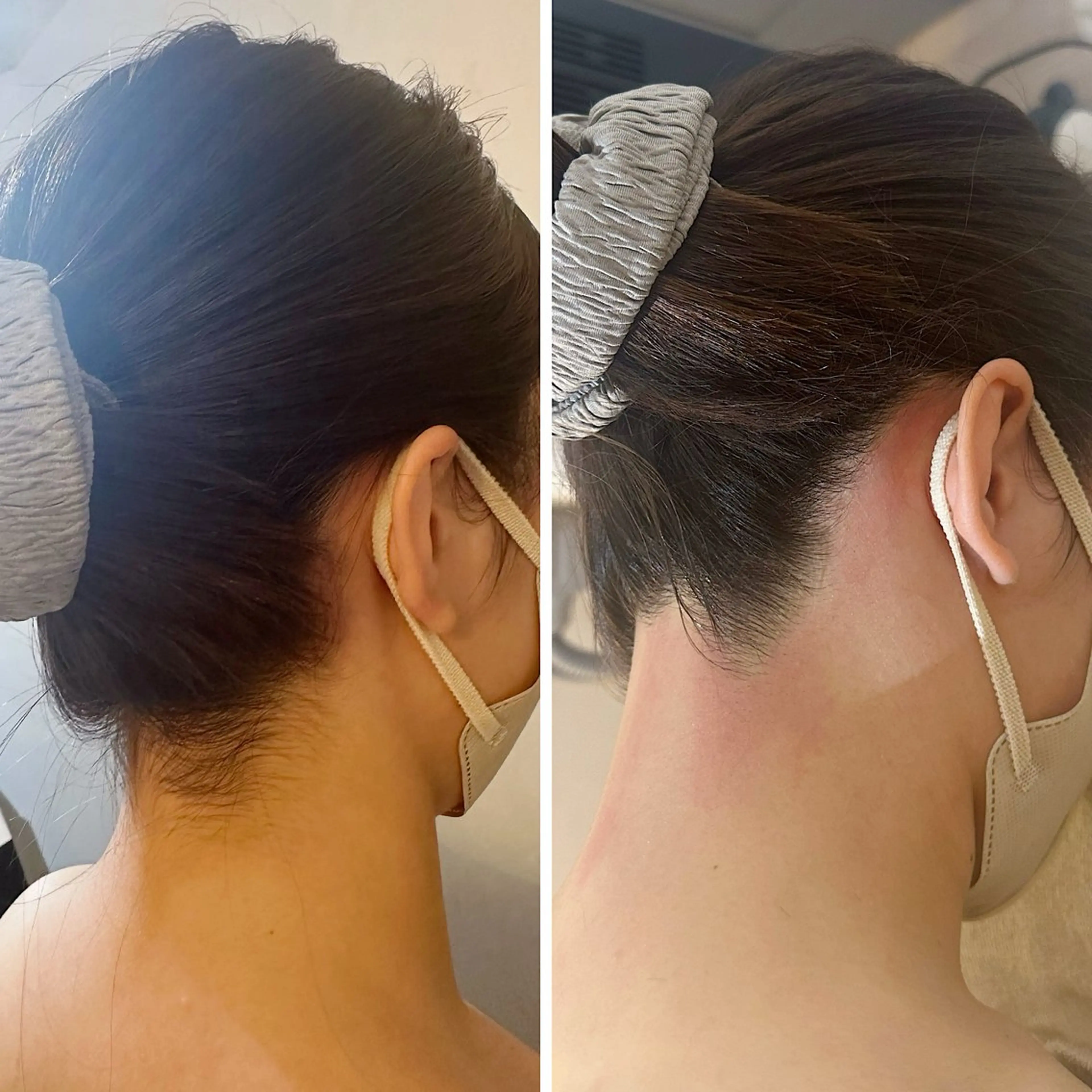 脱毛 うなじ脱毛/美肌脱毛 LABELのエステ・リラクイメージ