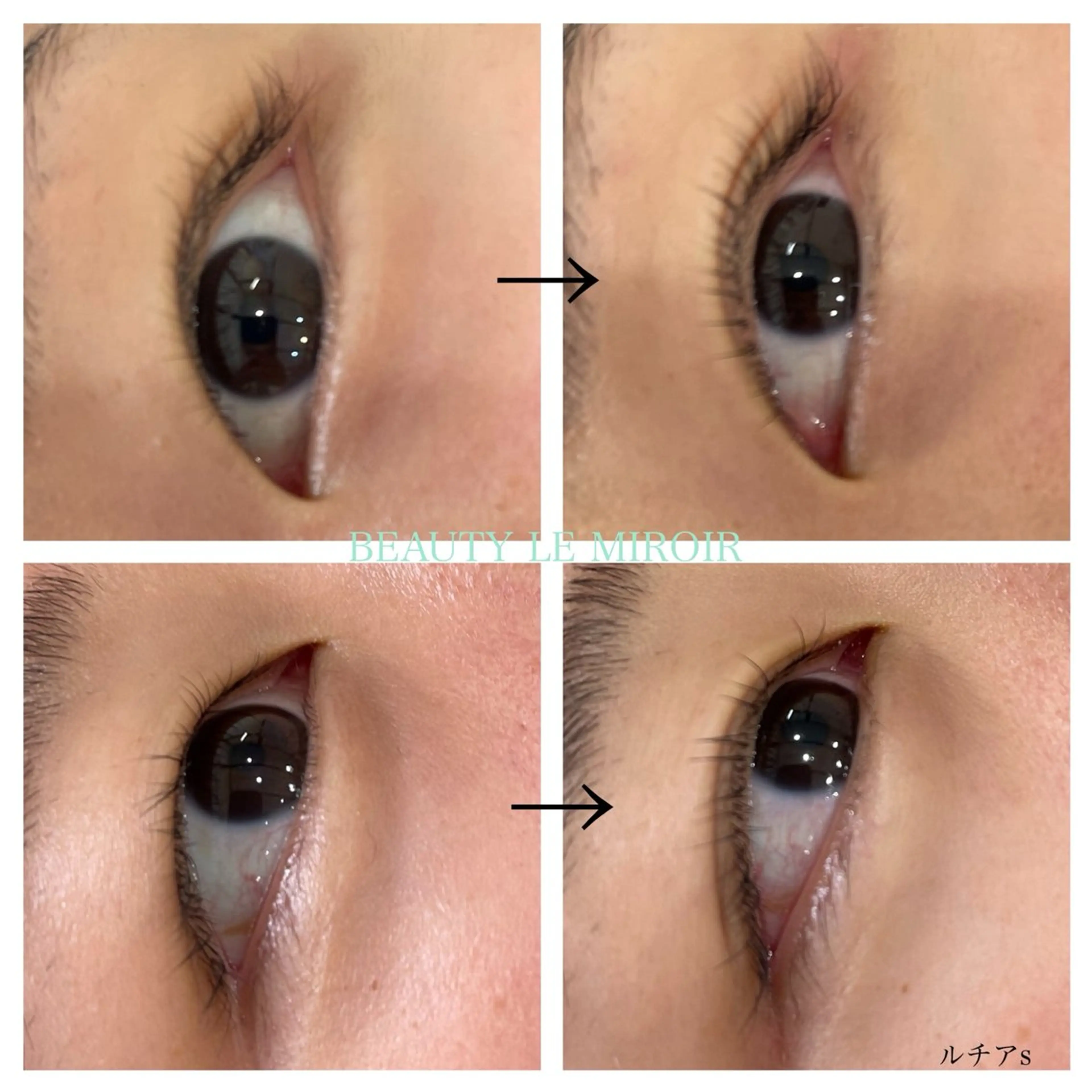 マツエク・マツパ ビューティー ミロワールのエステ・リラクイメージ