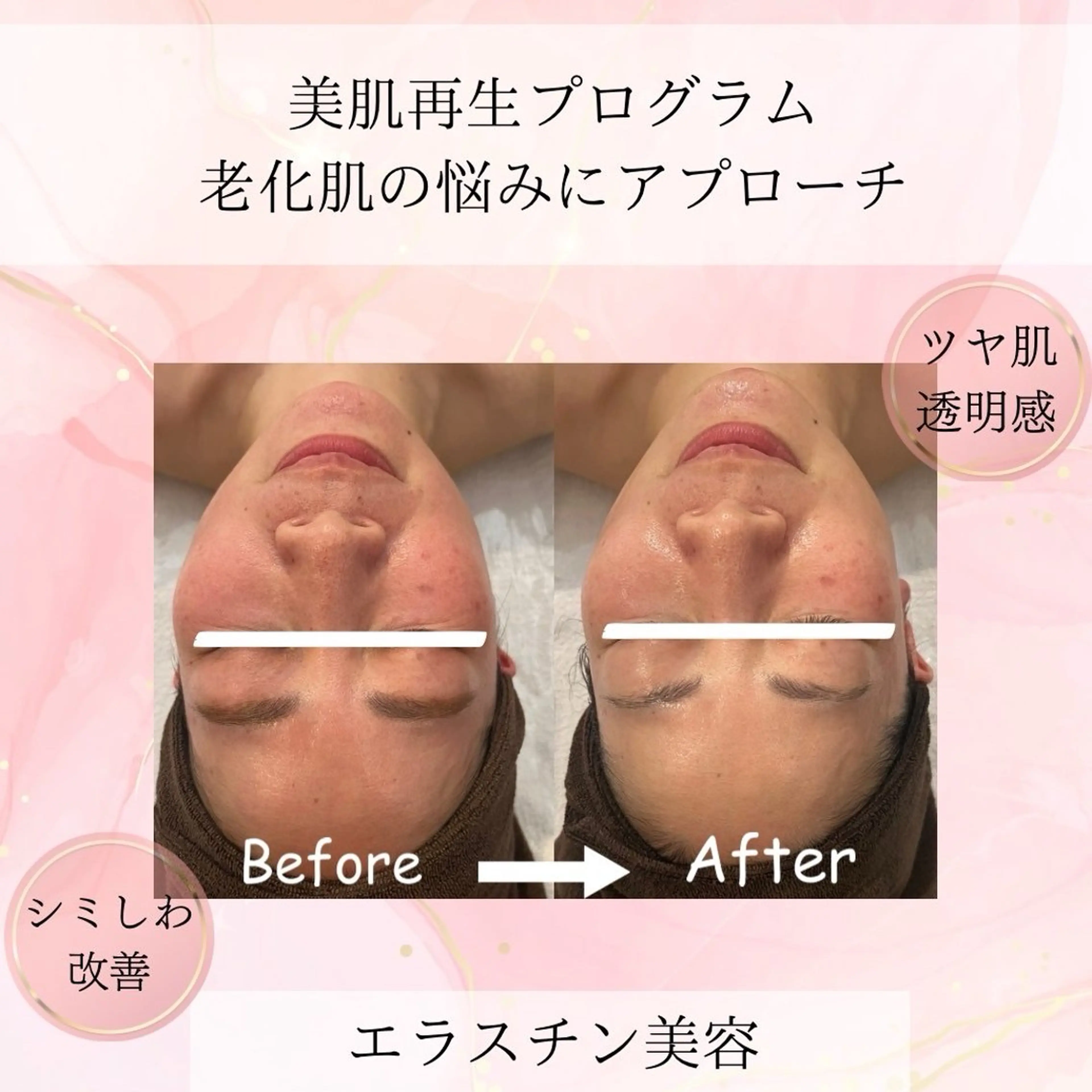 エステ beauty SalonRcoinのマツエク・マツパデザイン