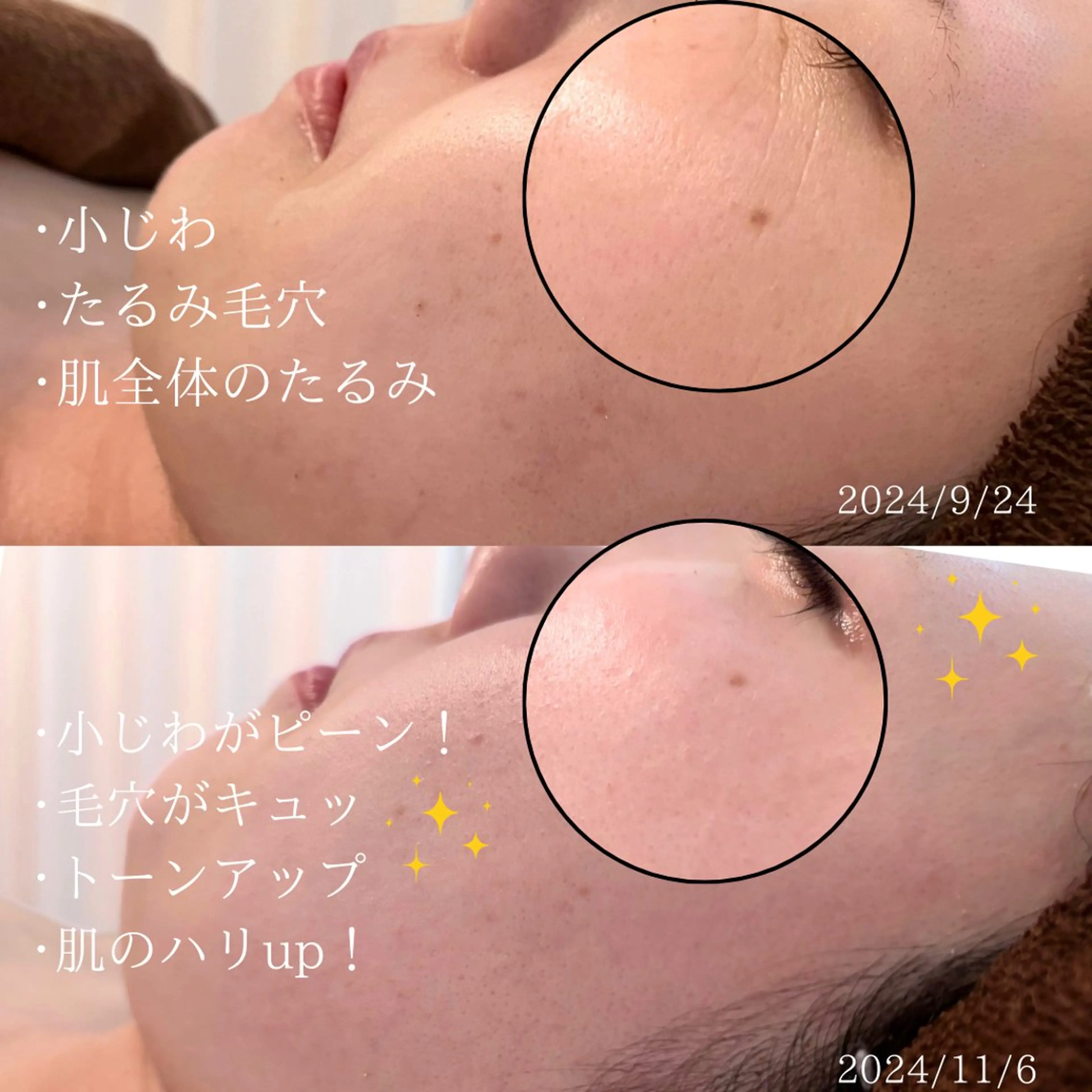 mison所属・mison 安形友花のネイルデザイン