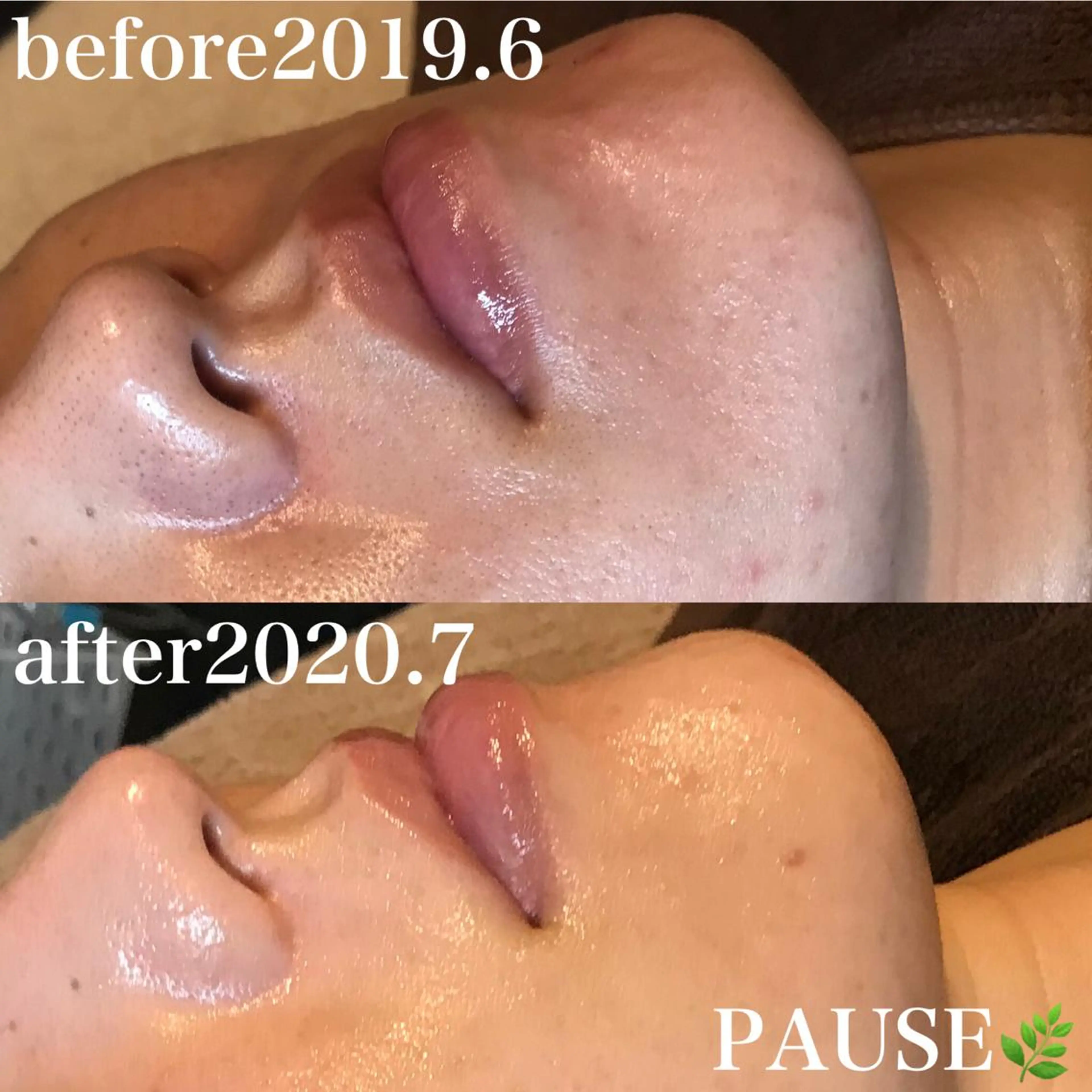 エステ 浜野 恵美のエステ・リラクイメージ