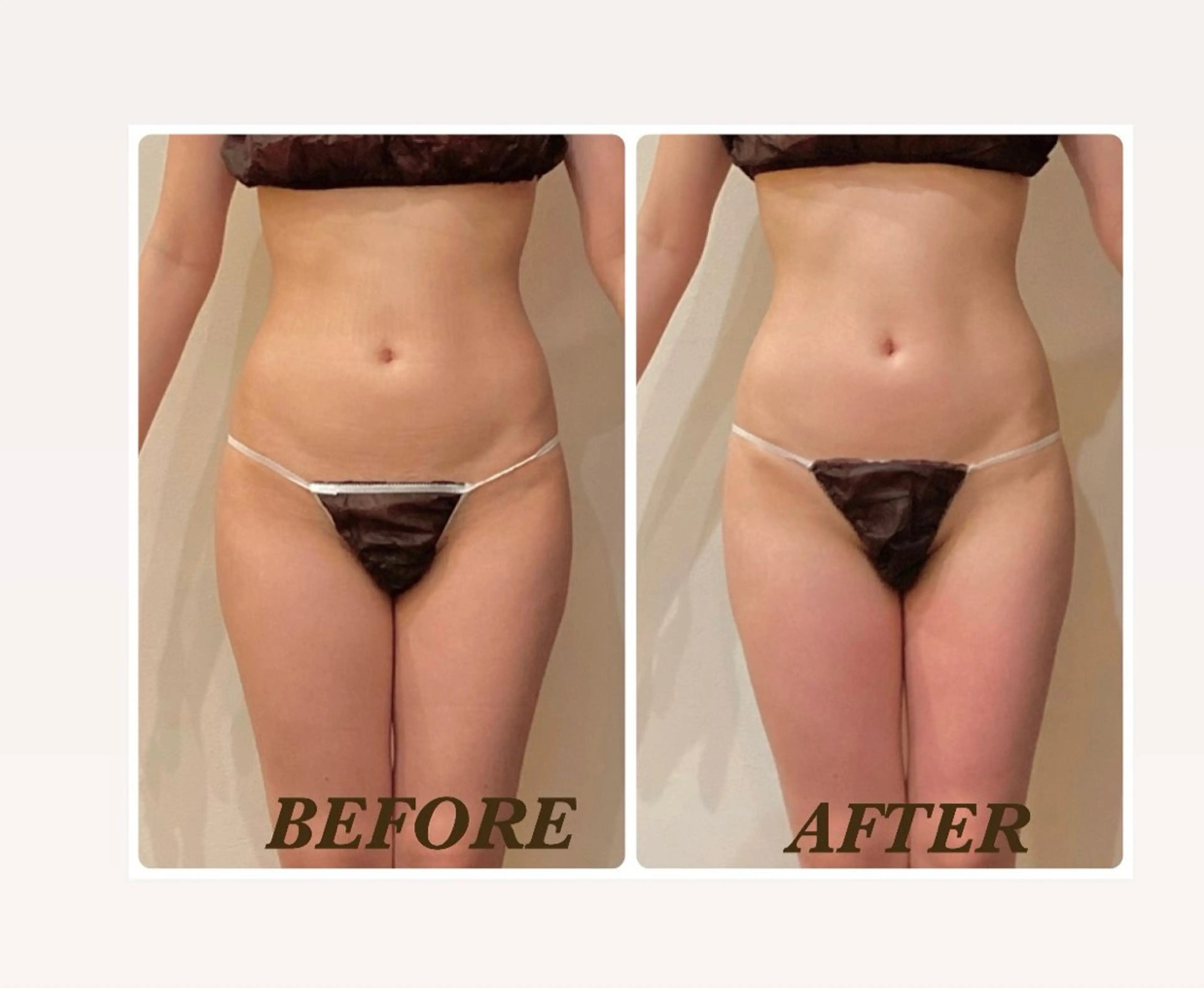 エステ リラク Prima〜プリマ〜 名古屋駅店所属・Prima 痩身脱毛 にごうかおりのエステ・リラクイメージ