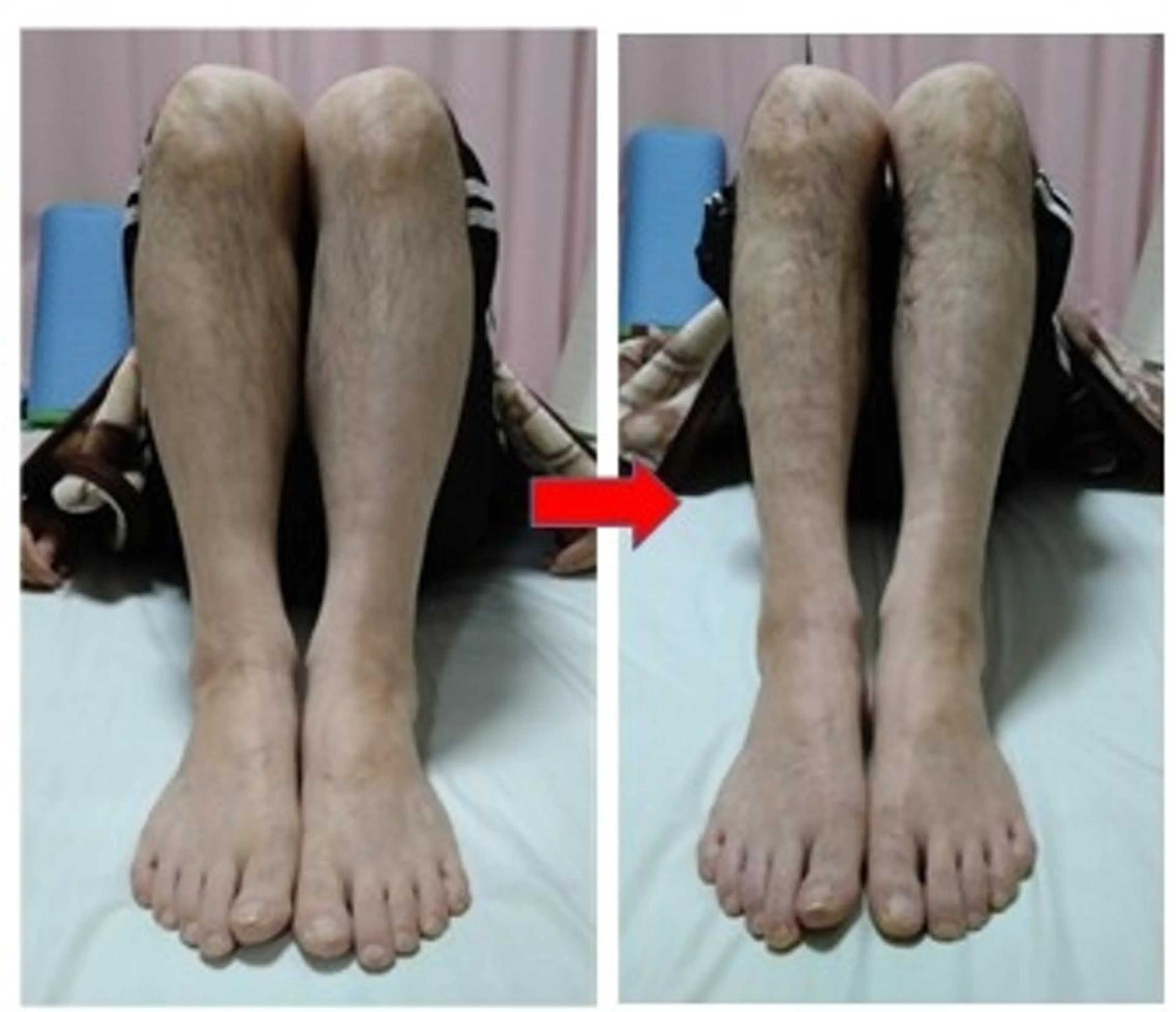 男性限定足スッキリ骨盤調整付(張り·むくみ冷えなど)の写真