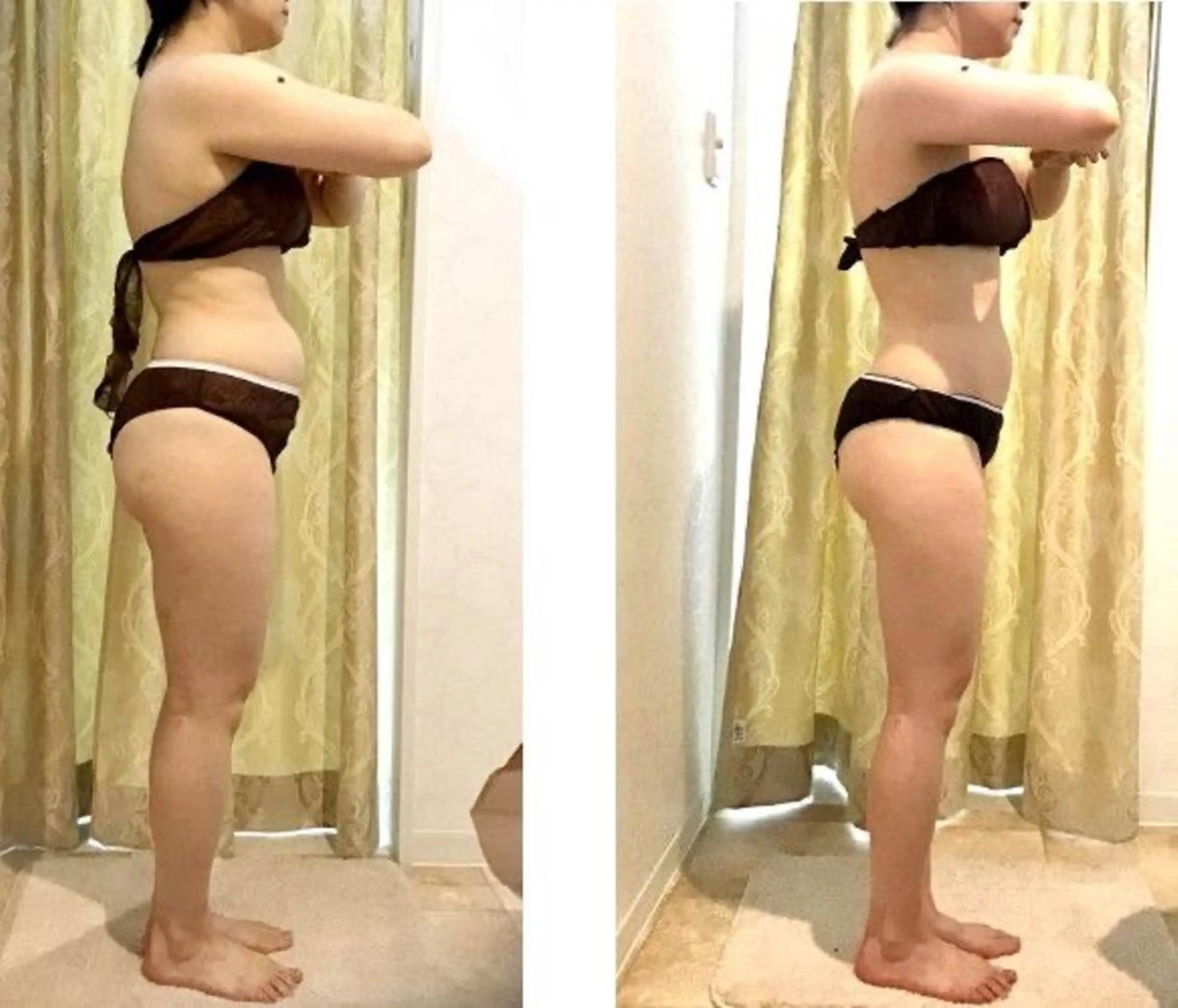 【最新痩身マシン打ち放題】一日に打てる上限ショット数打ち放題の写真