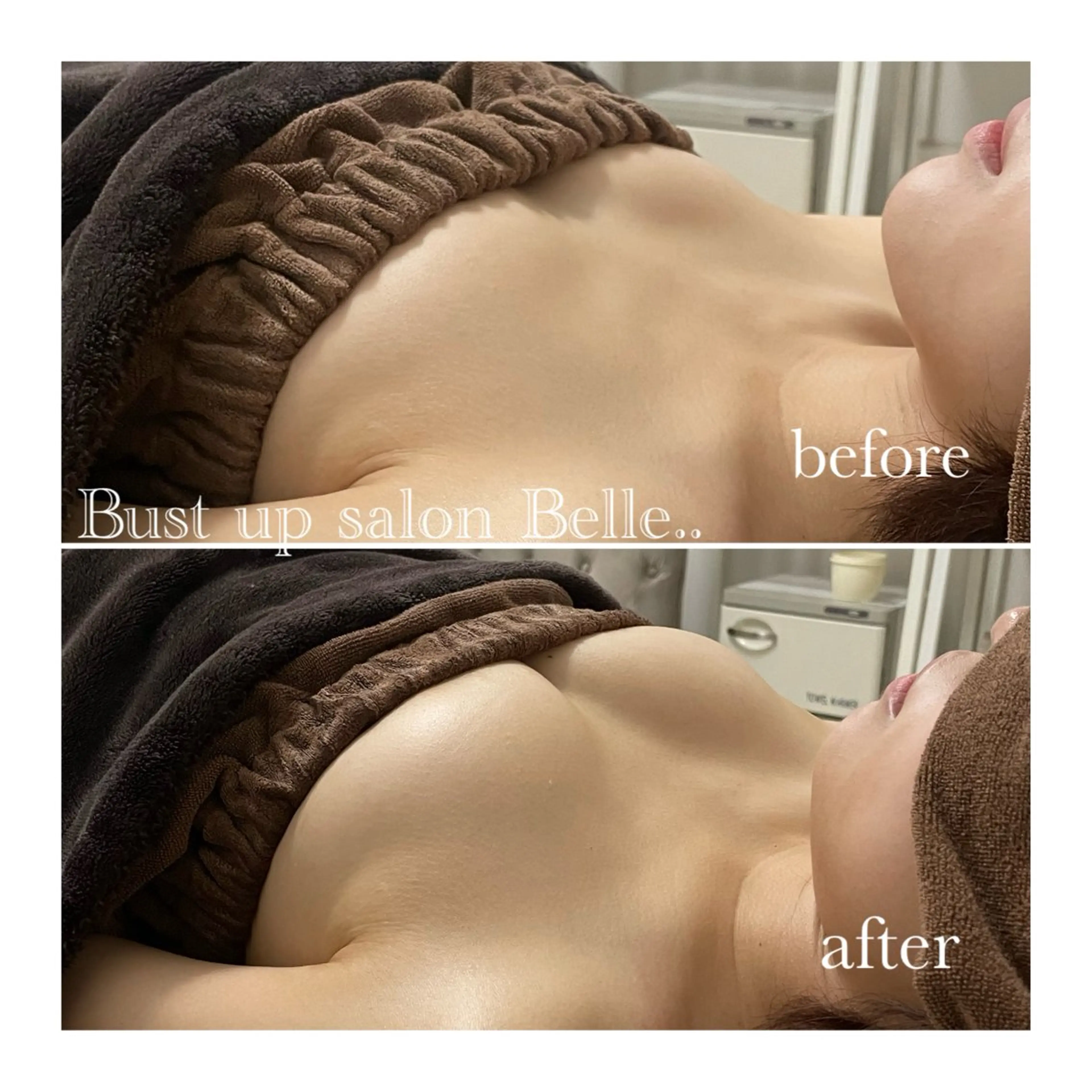 ミニモ限定お試し３回！通常価格3回で99000円の写真