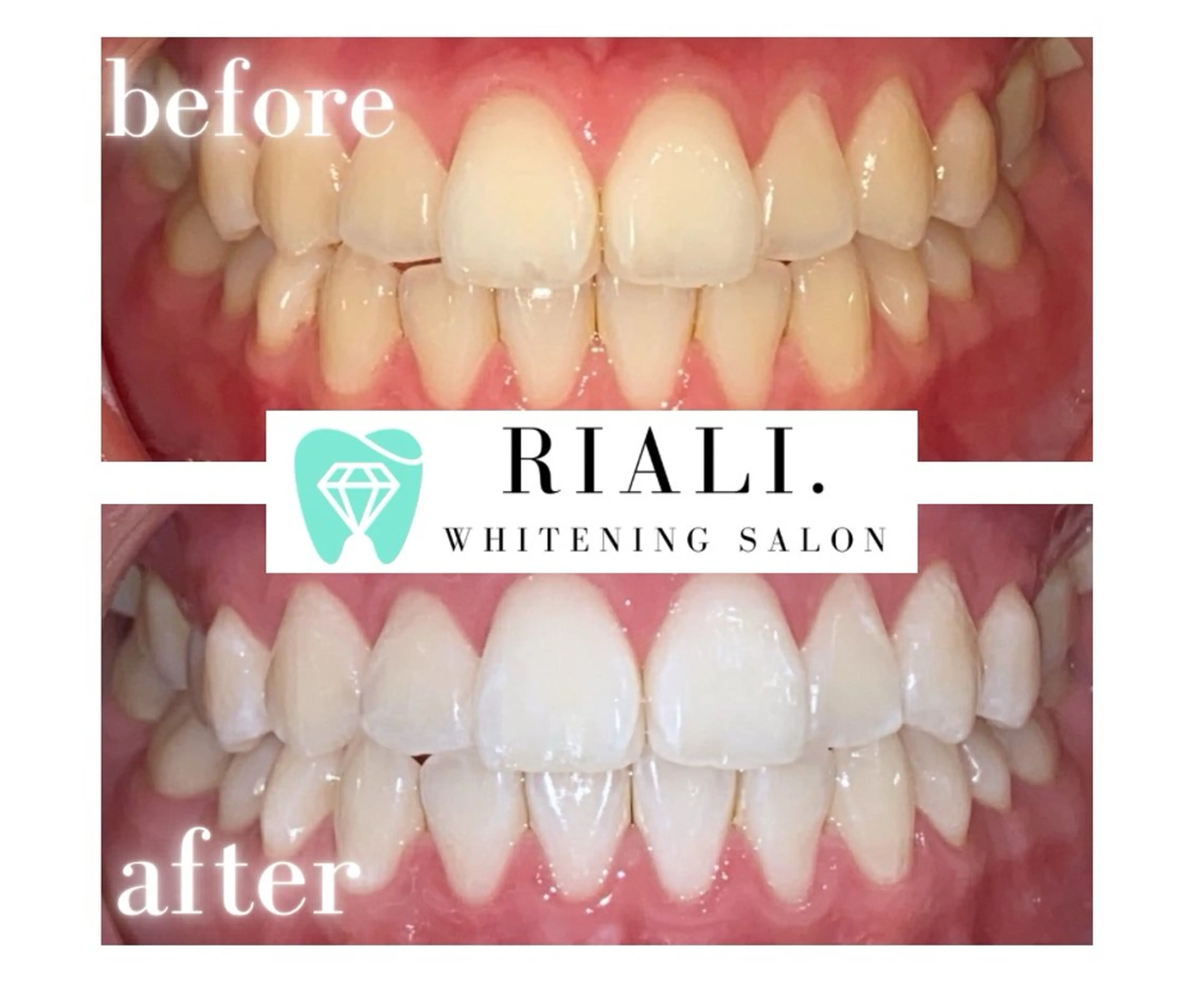 宮崎セルフホワイトニングサロンRIALI.所属・宮崎ホワイトニング サロンRIALI.のエステ・リラクイメージ