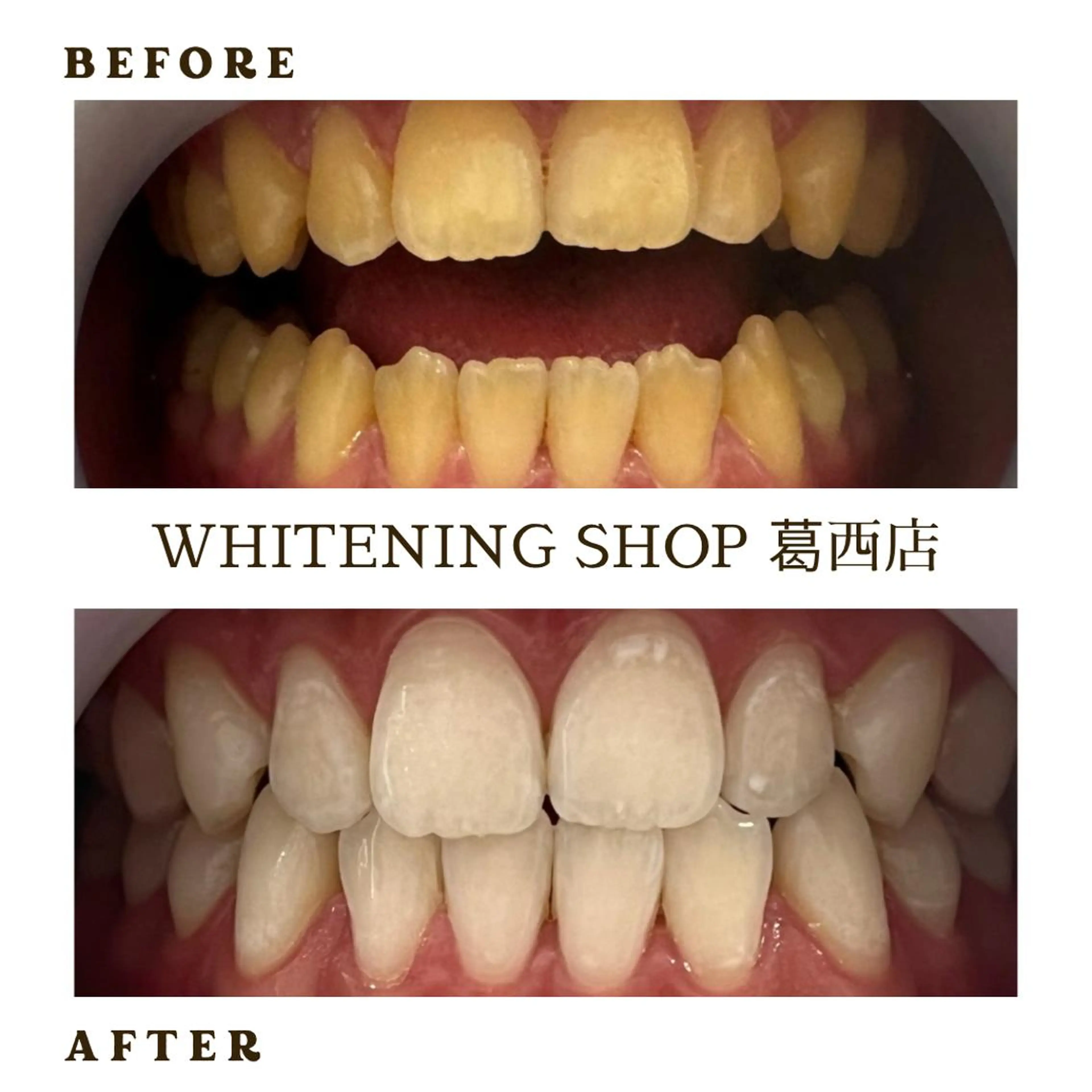 メンズ その他 ホワイトニング ショップ葛西店のその他イメージ