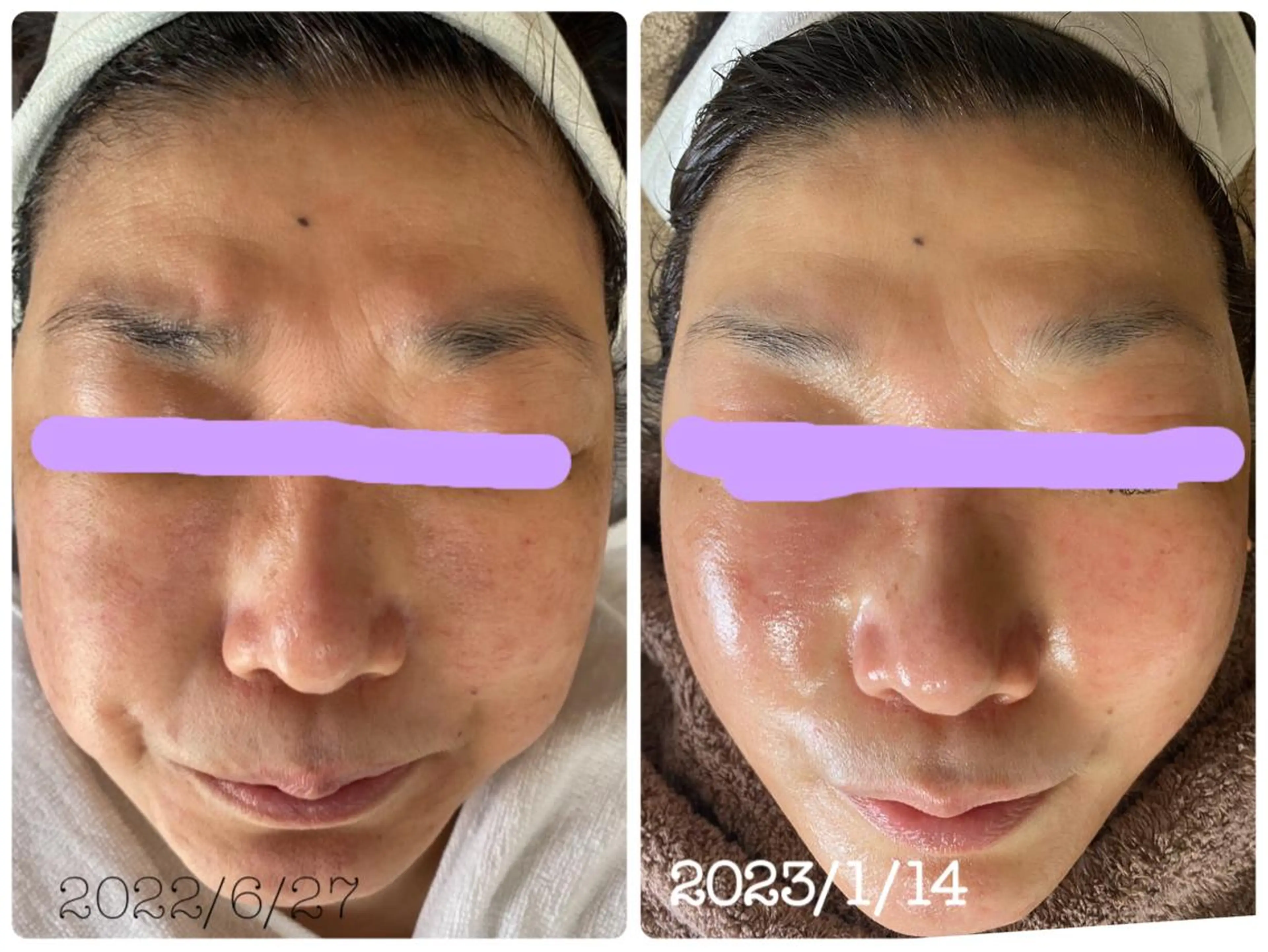 エステ エル美容室所属・oshima yuukiのマツエク・マツパデザイン