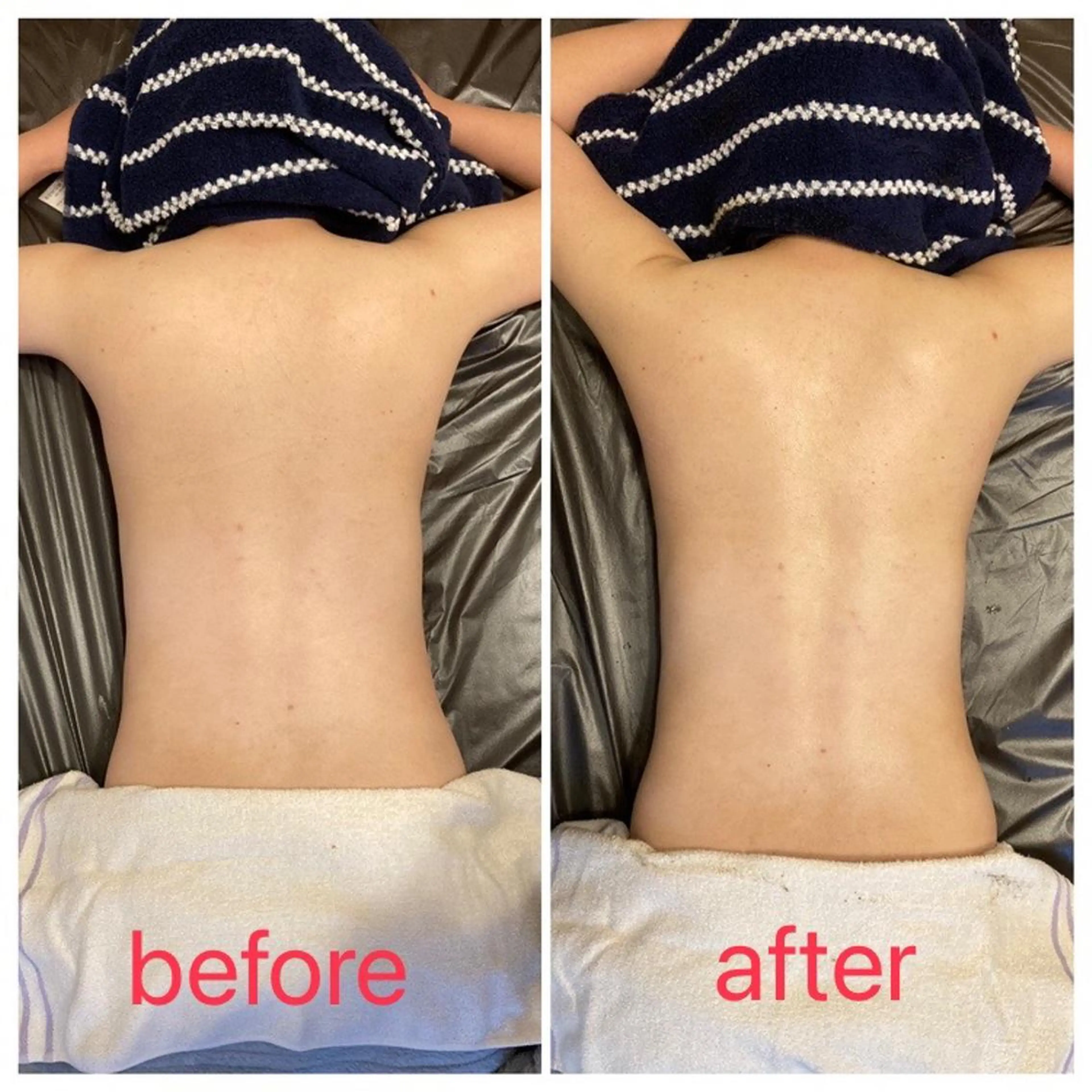 陶肌トリートメント【背中】の写真