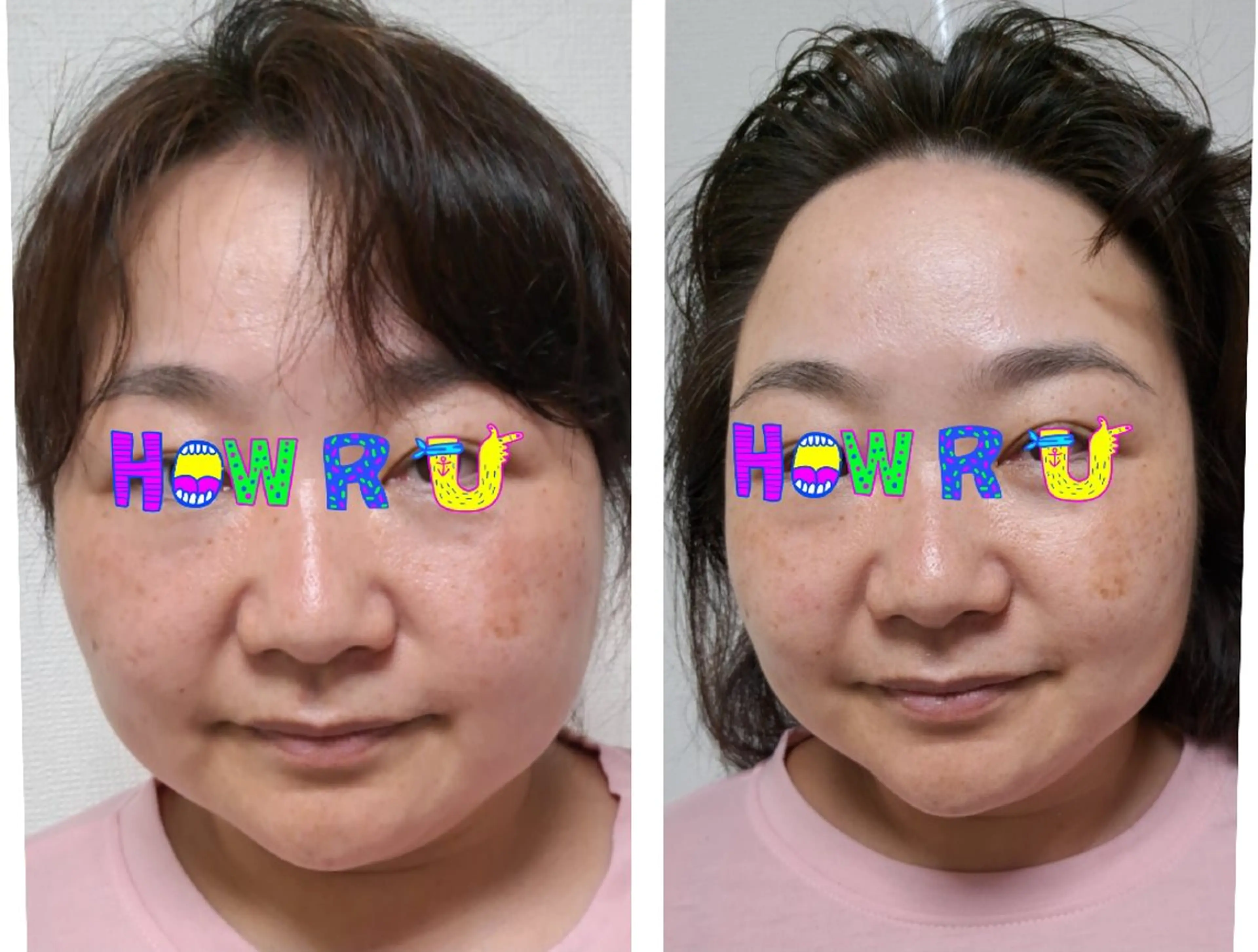 小顔整体(歪みを、整えて小顔に導きます)の写真