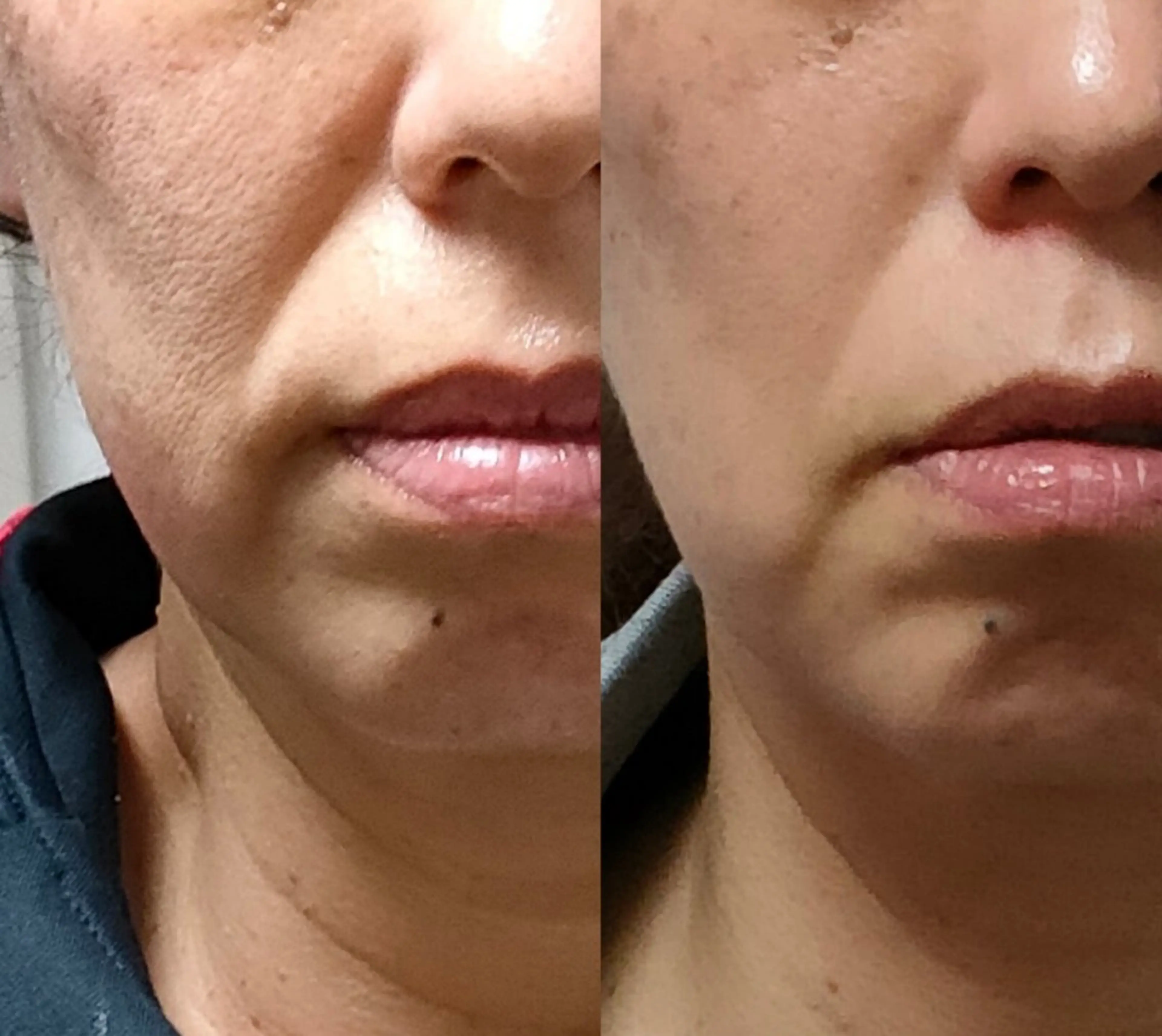 【贅沢小顔】美容液成分導入！骨格の歪み、筋肉のコリに、リンパにアプローチの写真