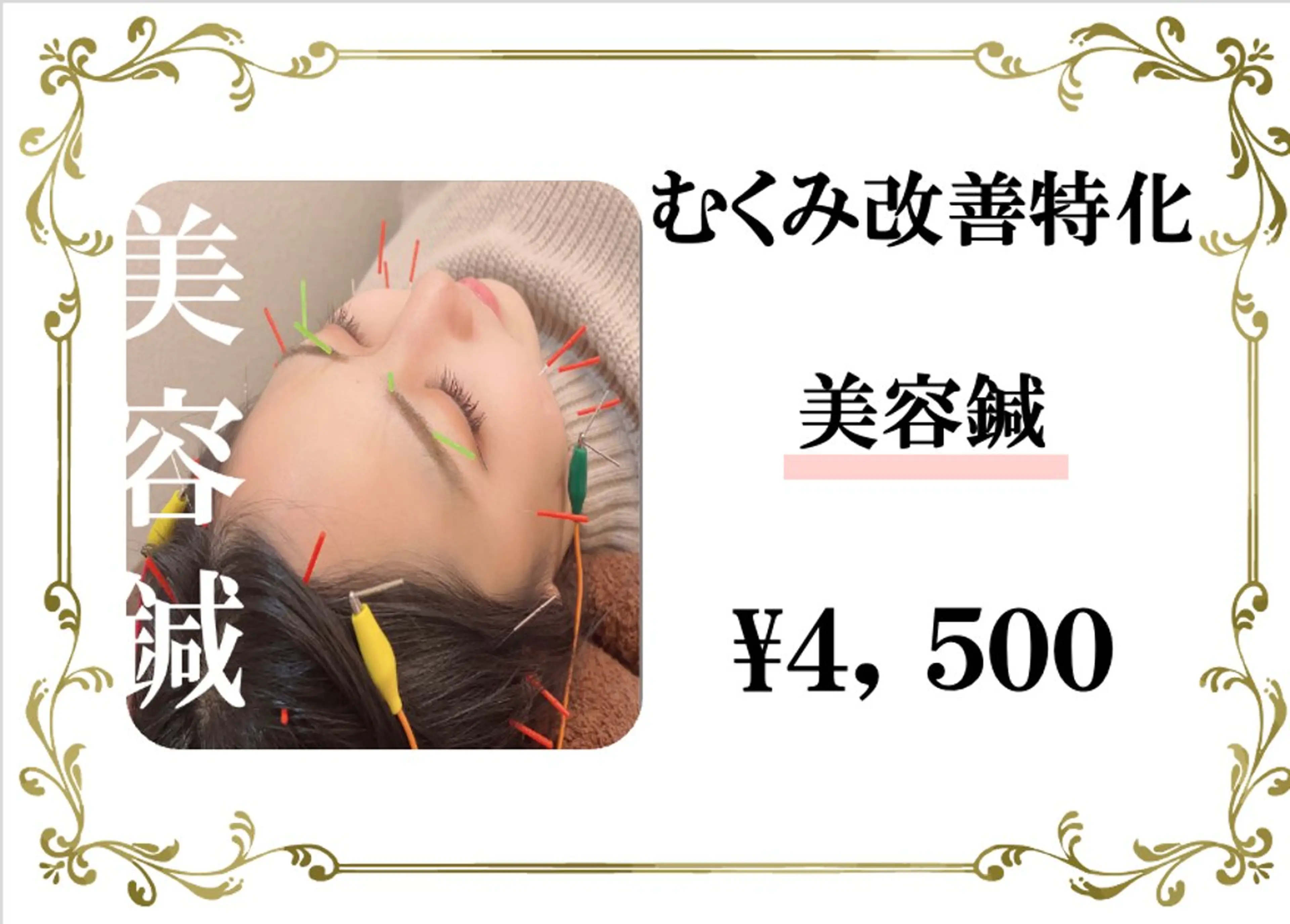 【口コミ限定】むくみ改善特化♪♪電気美容鍼￥4,500の写真