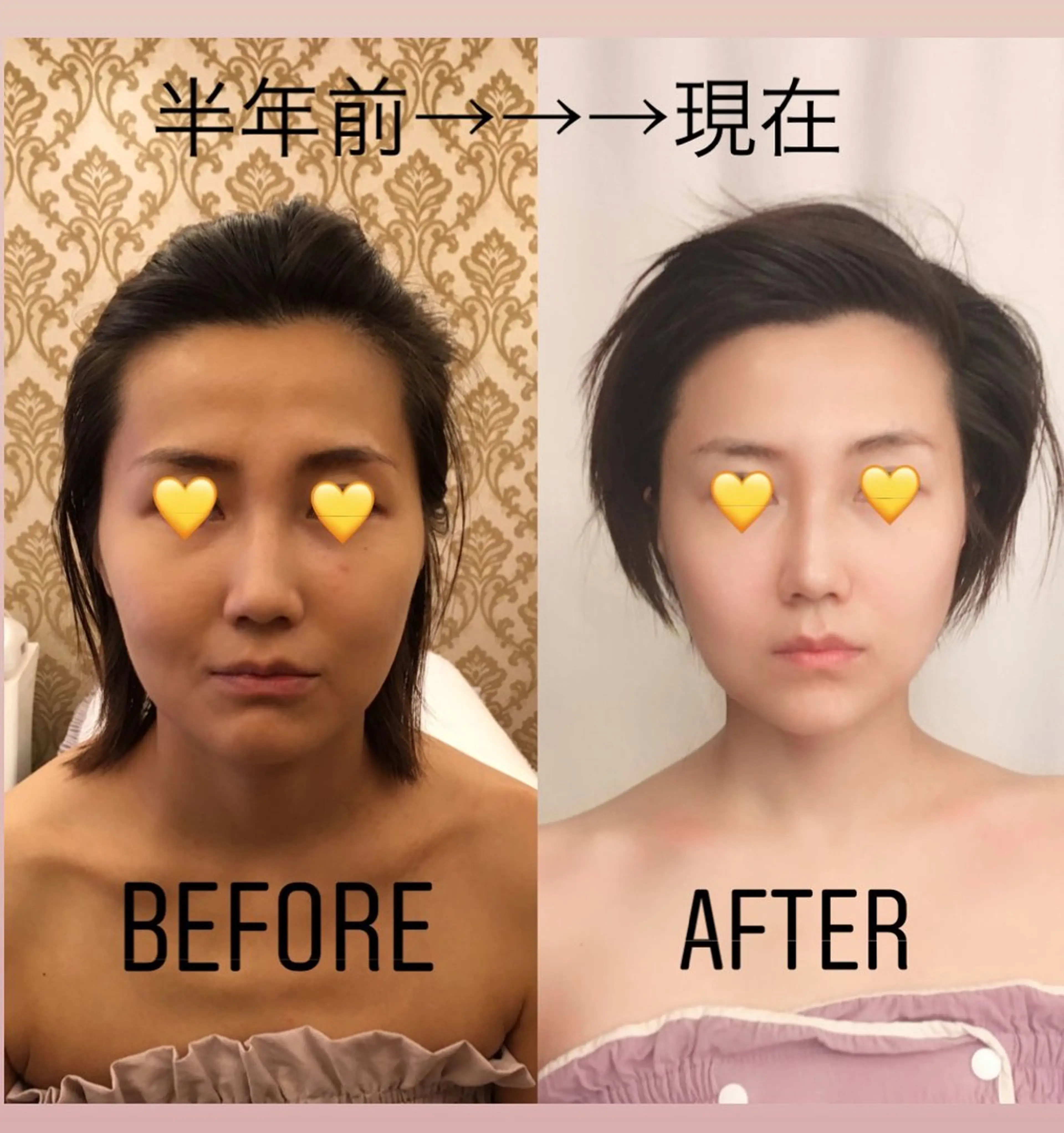 エステ リラク angeailes 小顔矯正サロンのエステ・リラクイメージ