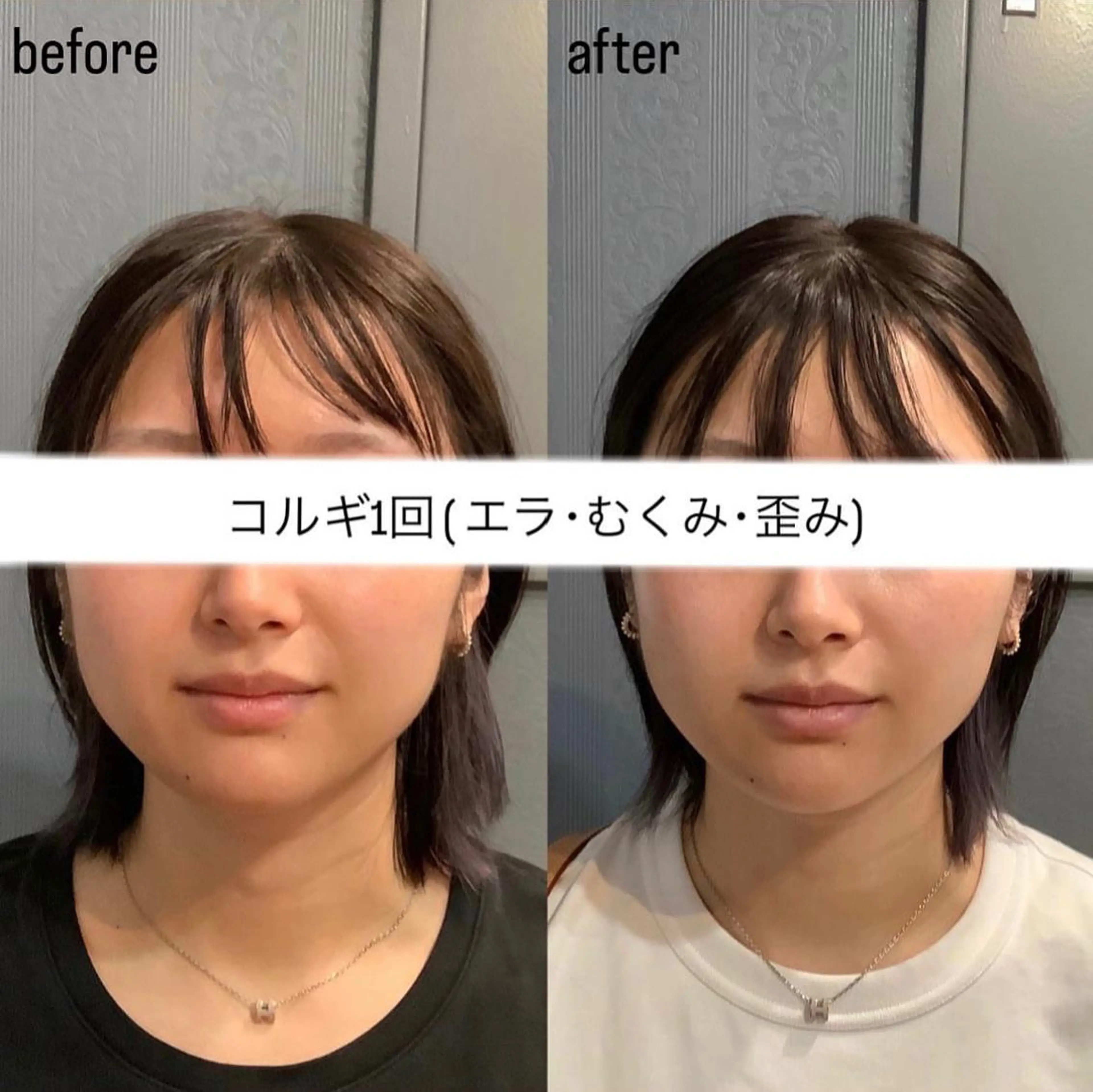 エステ リラク エステサロンino.colore'所属・小顔サロン ino.coloreのエステ・リラクイメージ