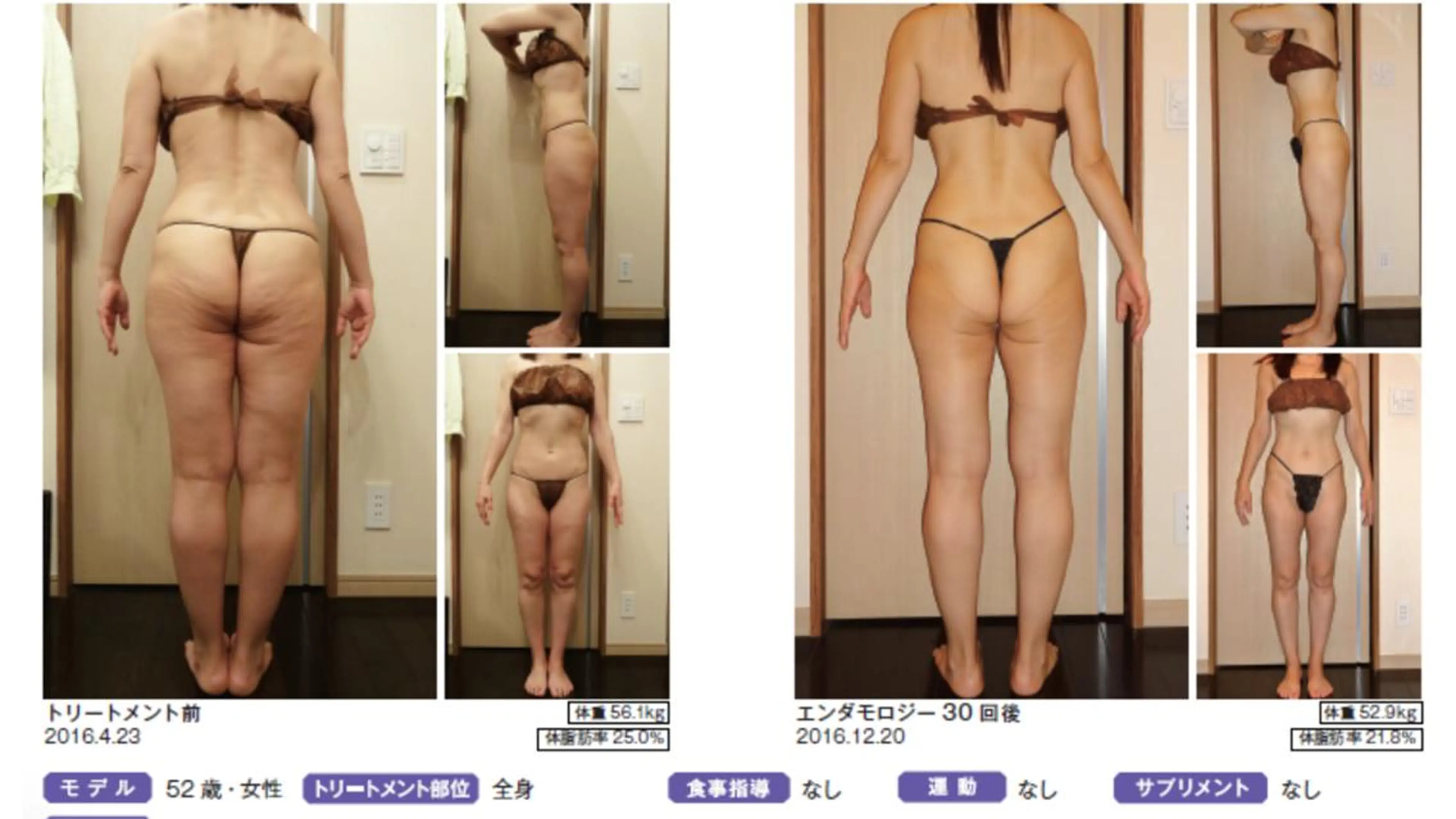 オレンジバナナ 新潟店のエステ・リラクイメージ