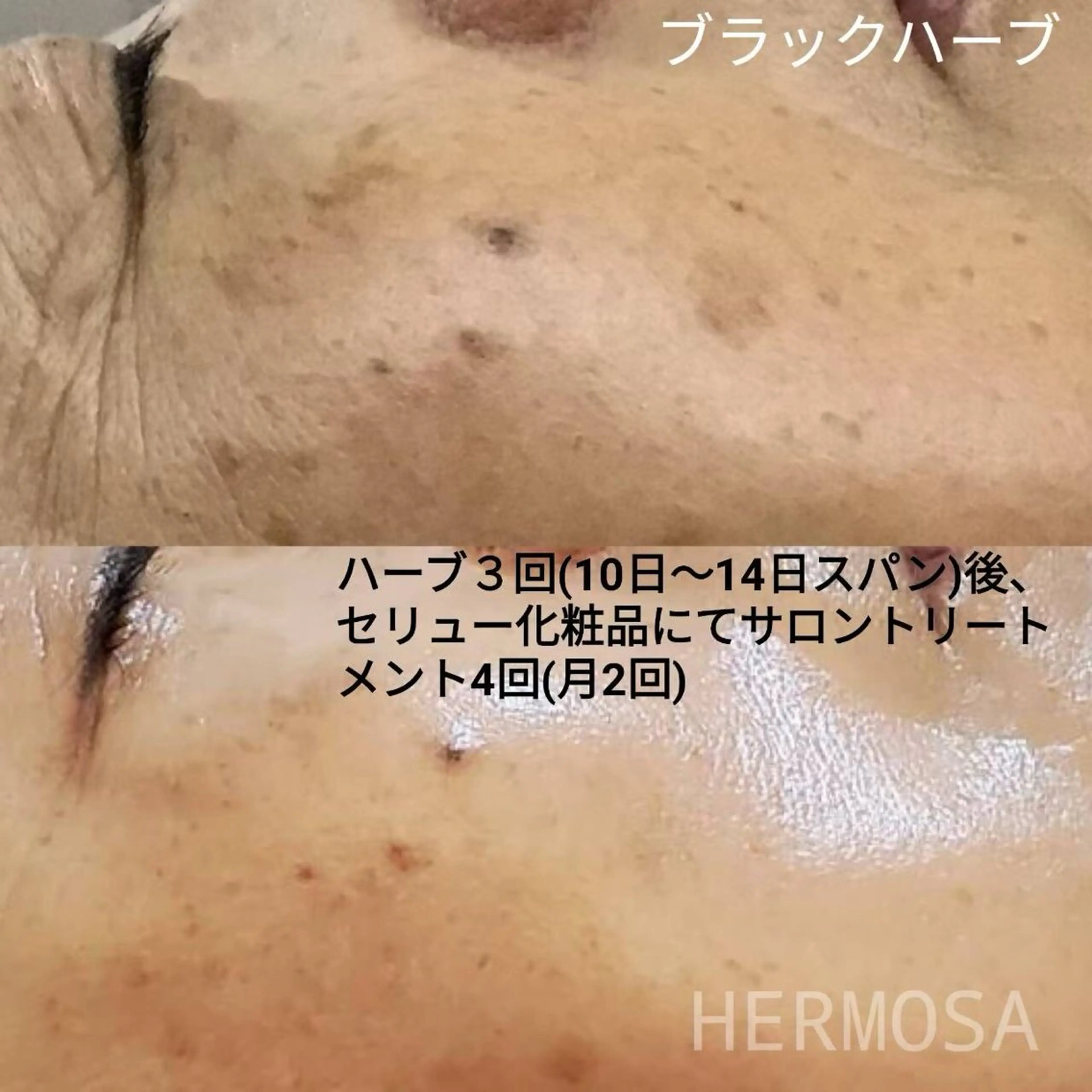 オールハンド フェイシャルのエステ・リラクイメージ