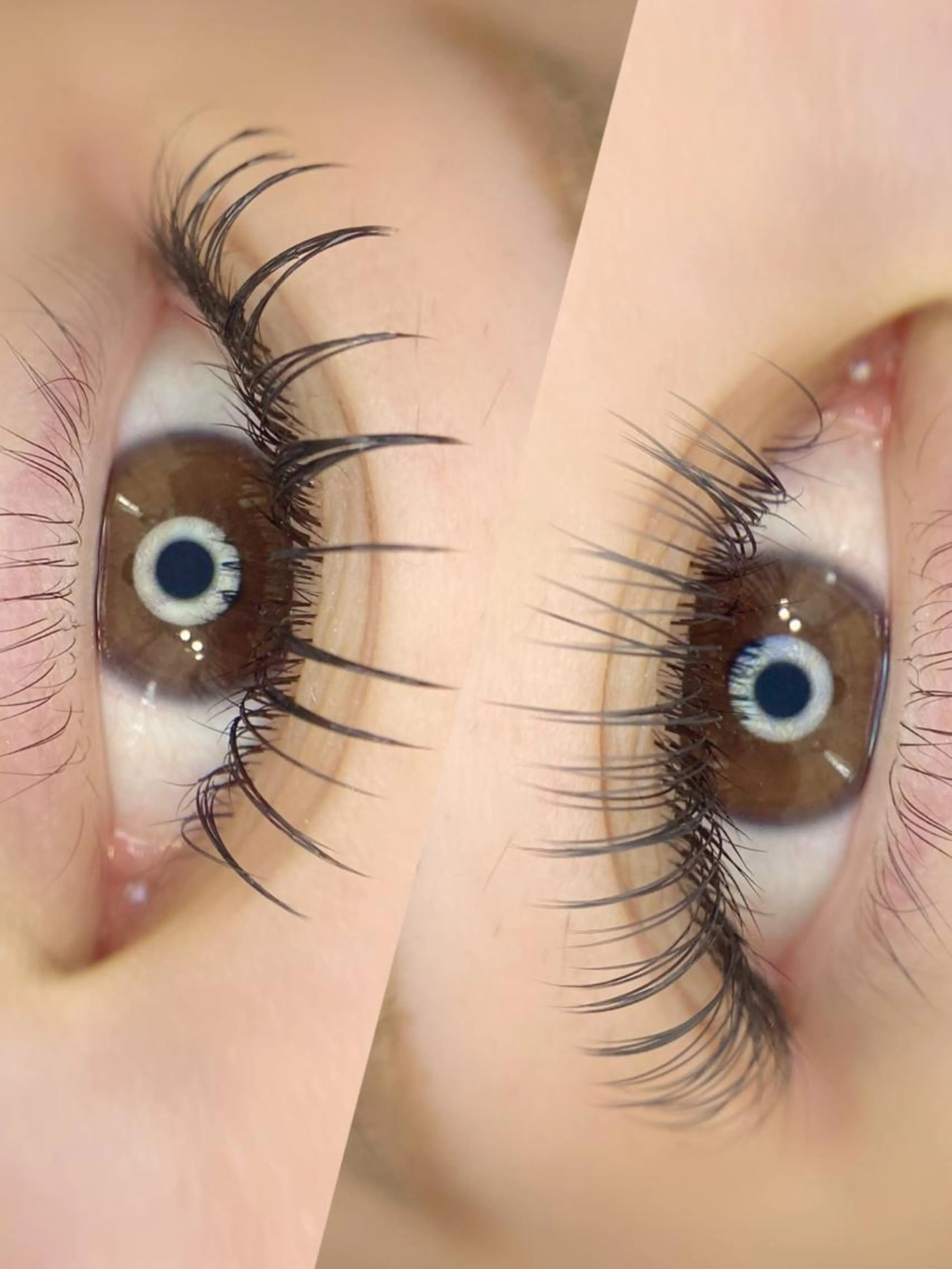 フラットラッシュ140本までの写真