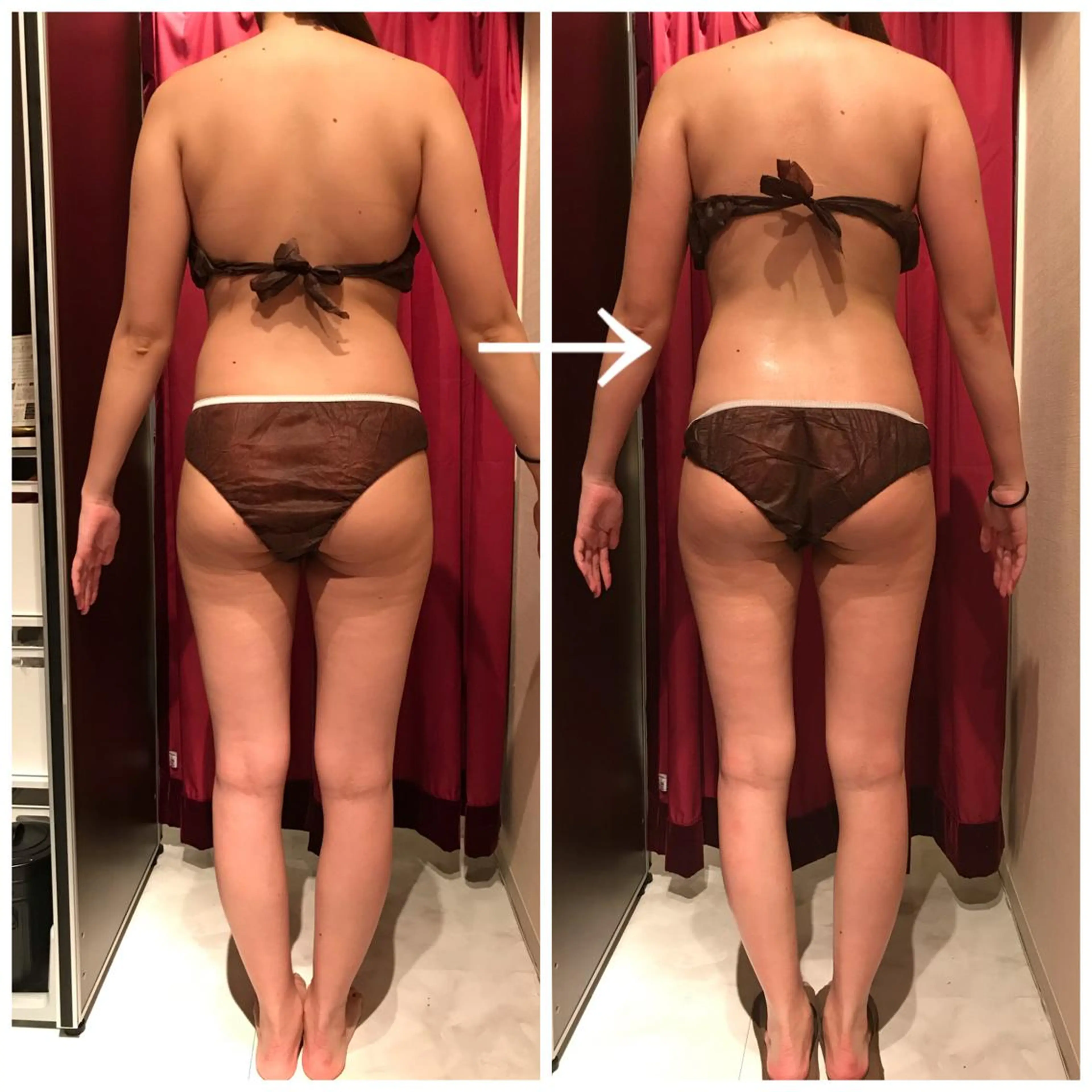 Cielo(シエロ) ダイエット専門店のエステ・リラクイメージ