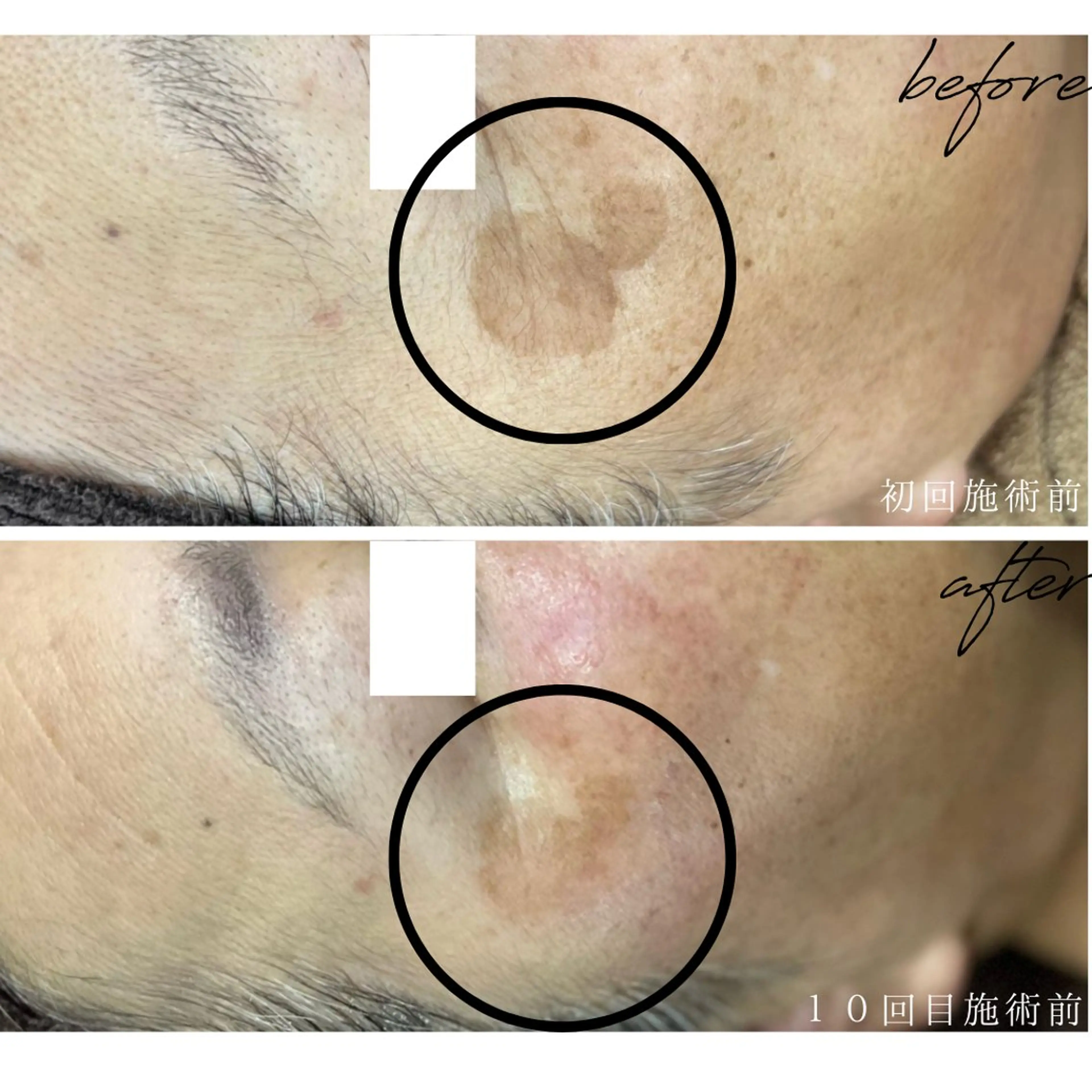 エステ 最新シミケアLily de pearlのエステ・リラクイメージ