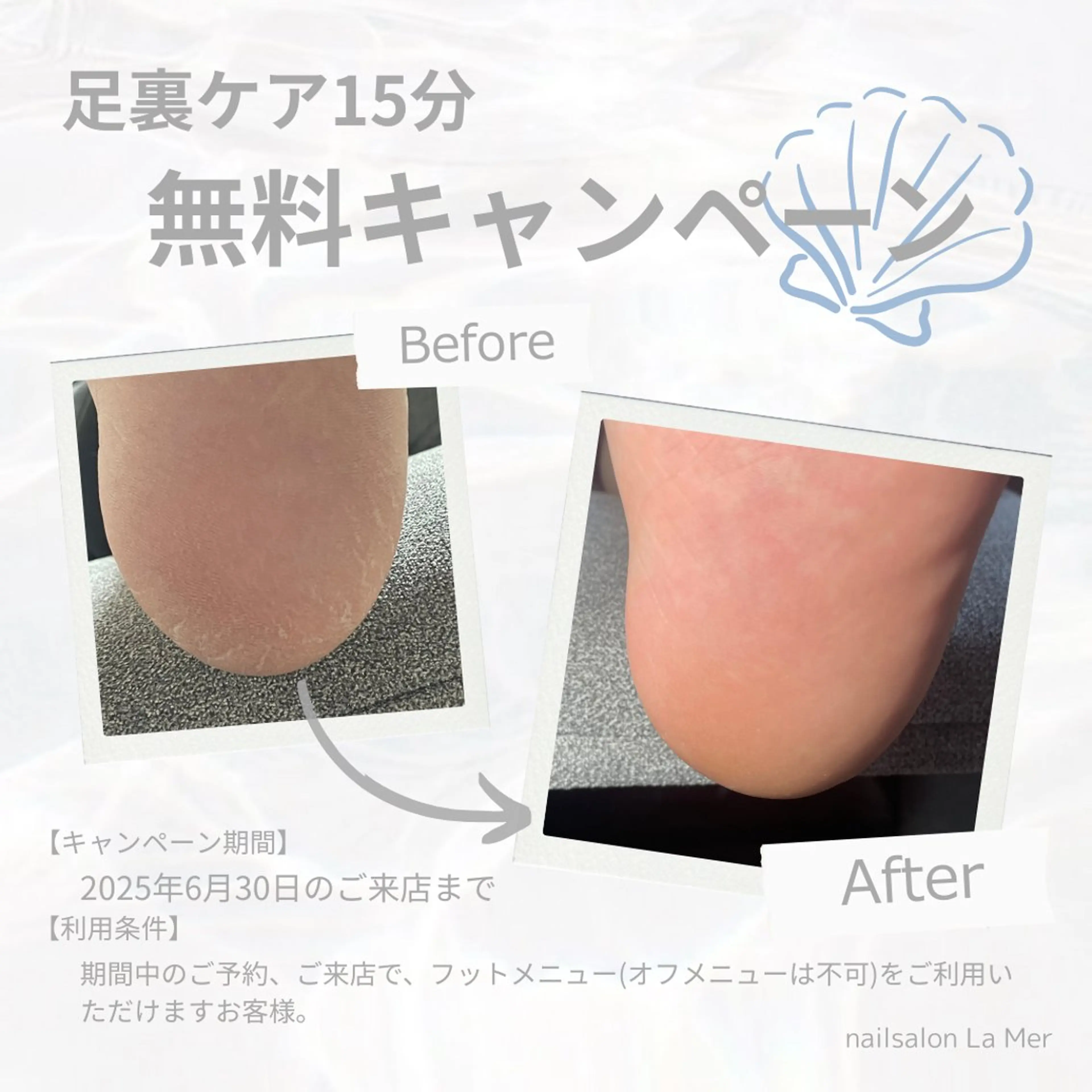 足裏角質ケアの写真