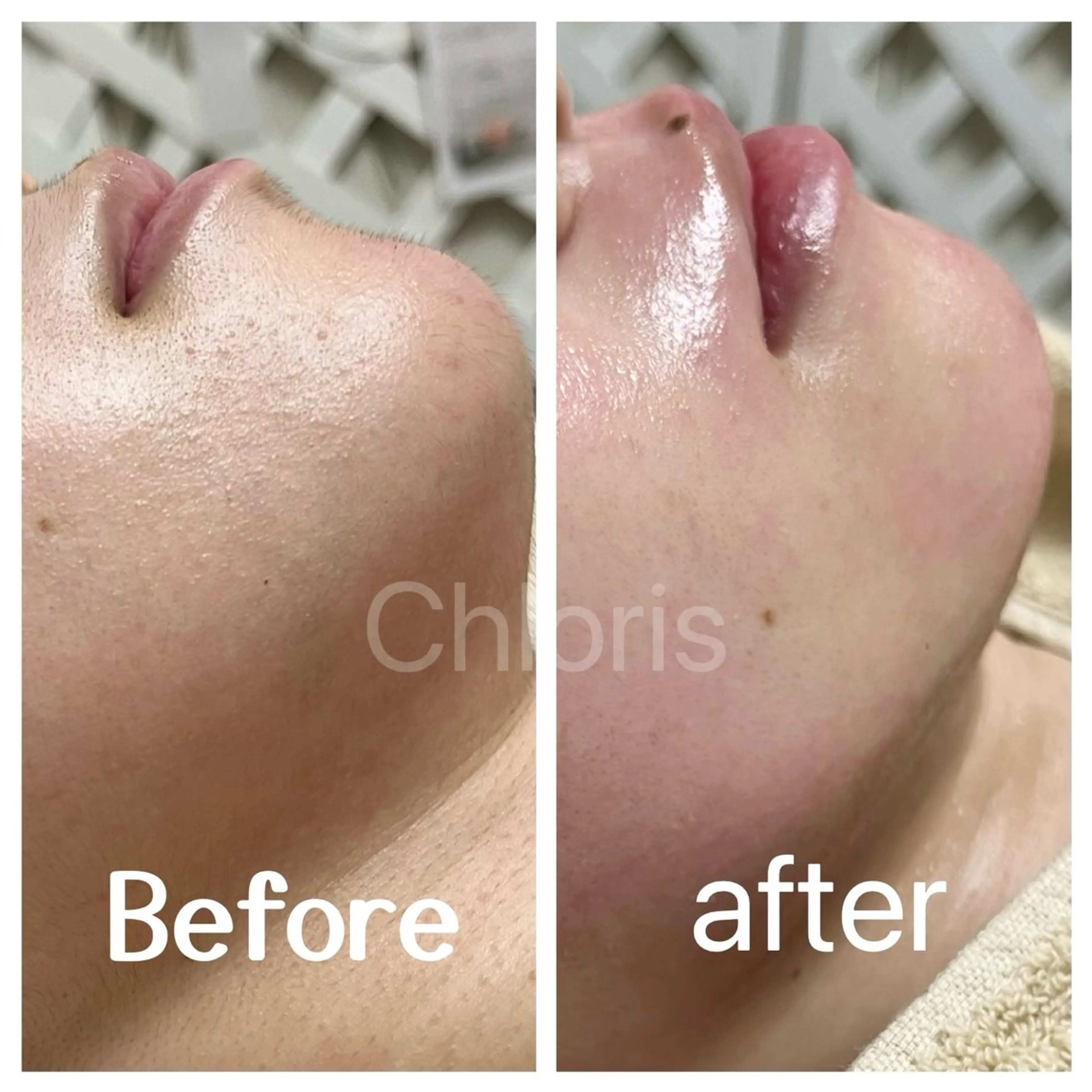 川越ローマピンク 光脱毛＆ワックス脱毛のエステ・リラクイメージ