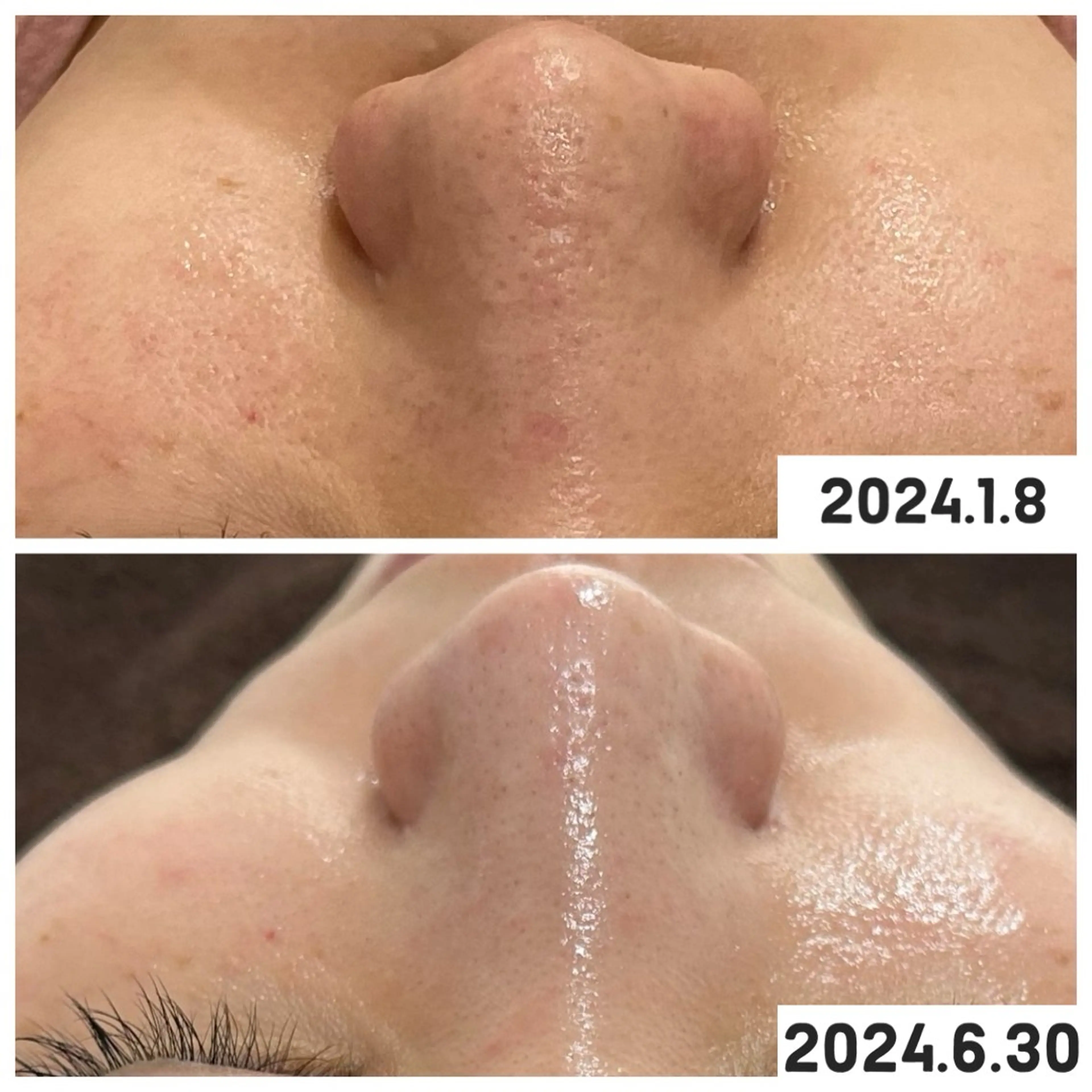 エステ 【現役看護師】高来 笑子のエステ・リラクイメージ