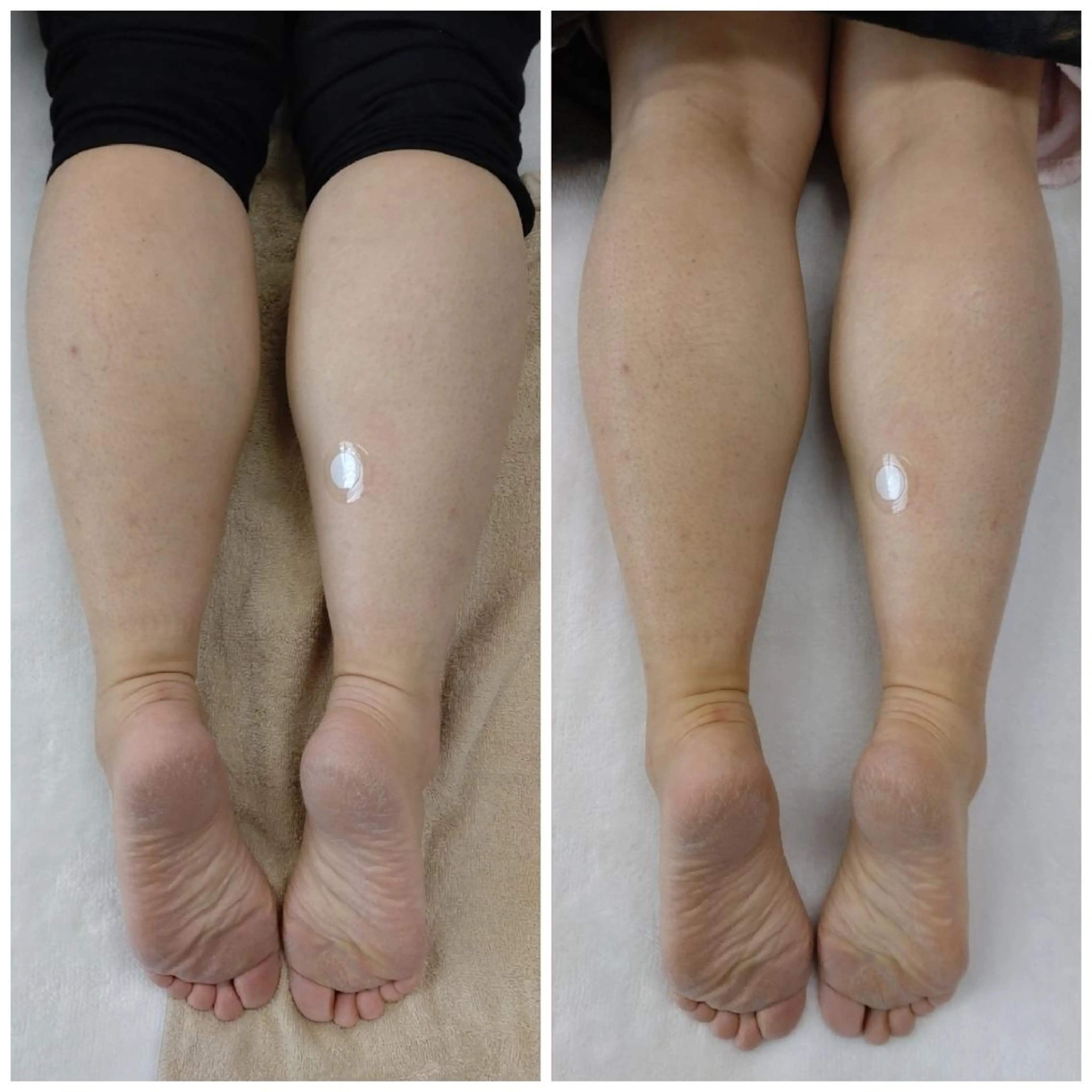 カイロプラクティックほほえみ所属・骨格　頭蓋骨調整 Rocco Aliのその他イメージ