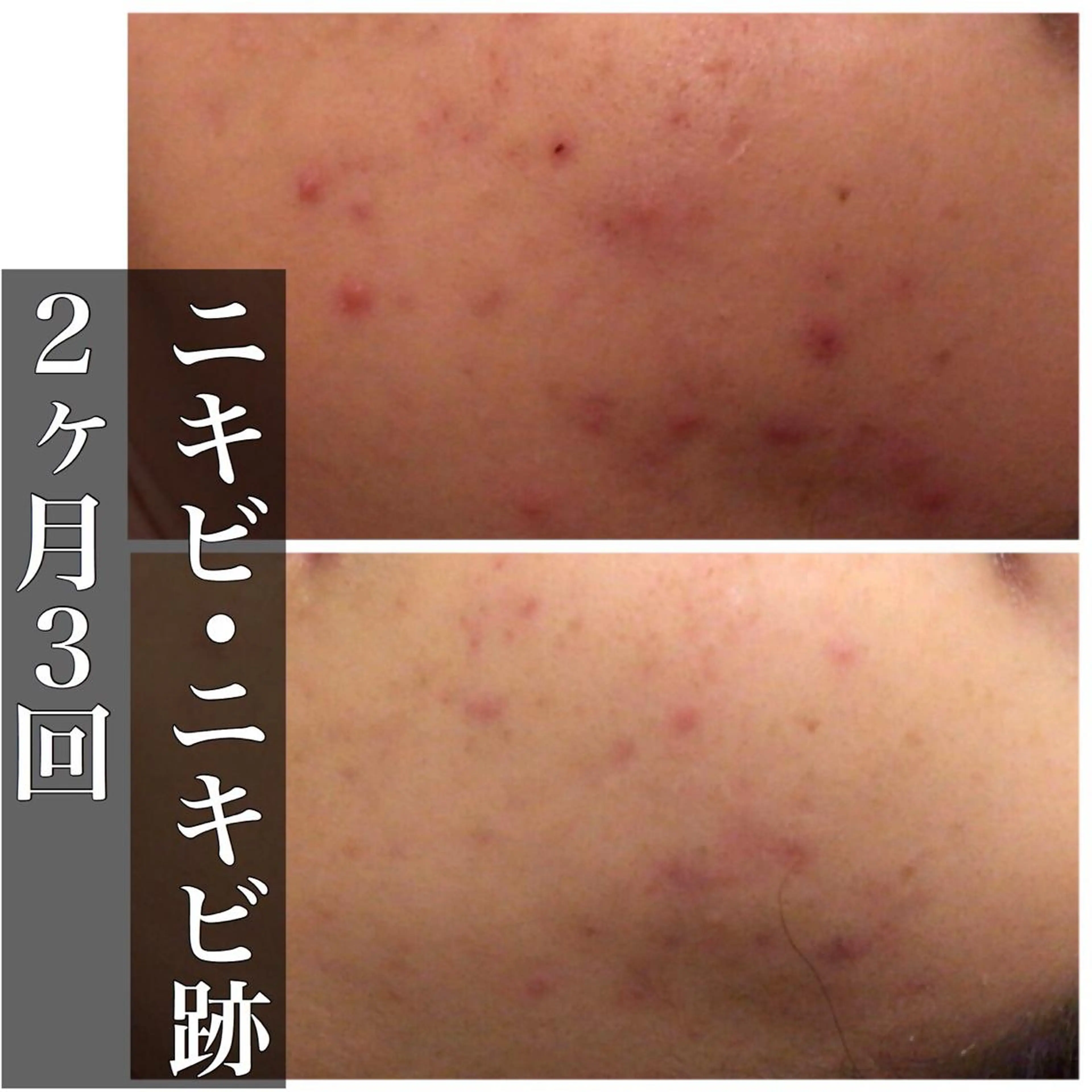 ミディアム カラー パーマ ヘアアレンジ メンズ キッズ ネイル マツエク・マツパ エステ リラク ニキビ・肌質改善専門 ♡人生が変わるサロンのエステ・リラクイメージ