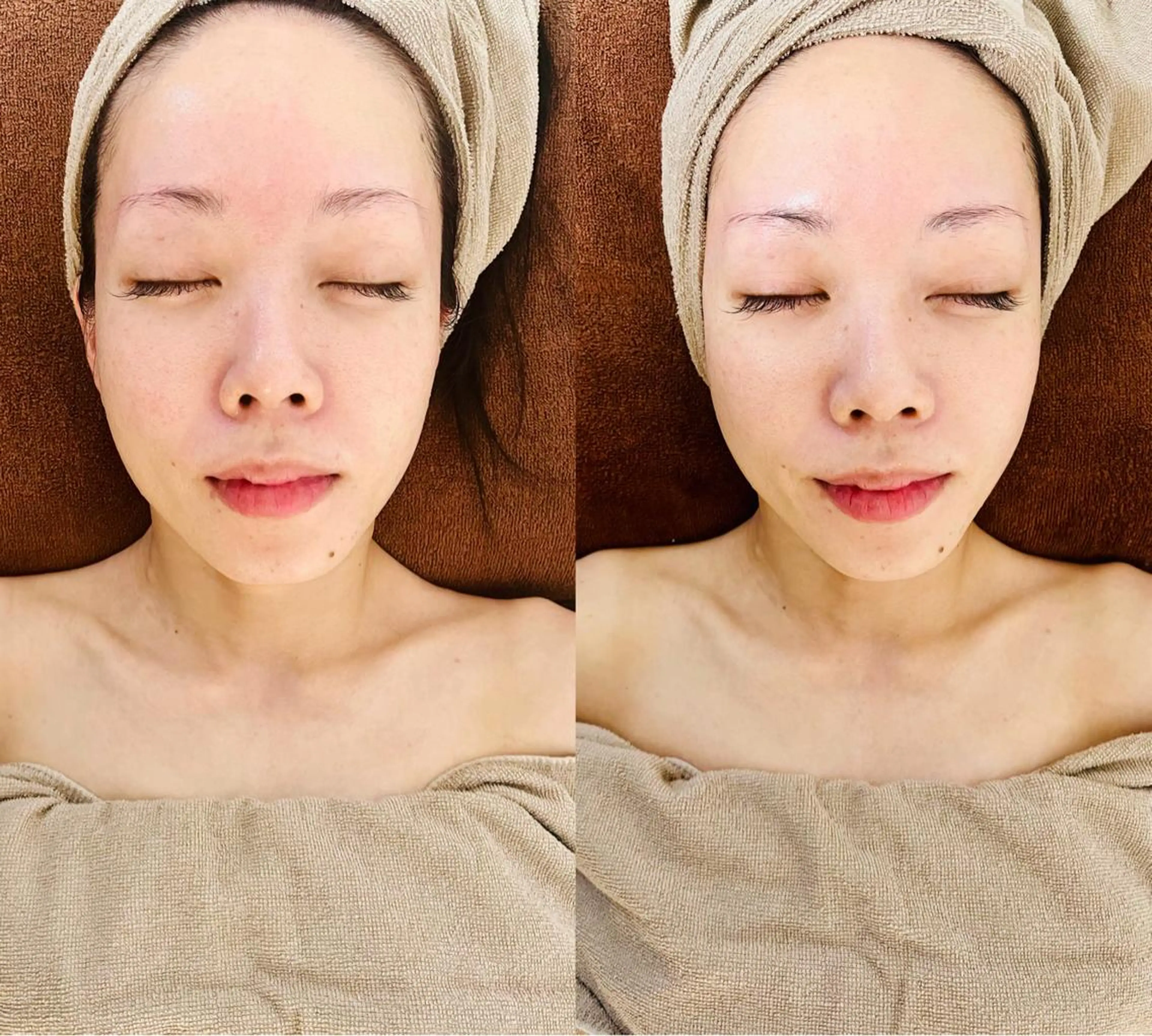 espoir所属・espoir🌿 FHR脱毛・ﾏﾂﾊﾟのエステ・リラクイメージ