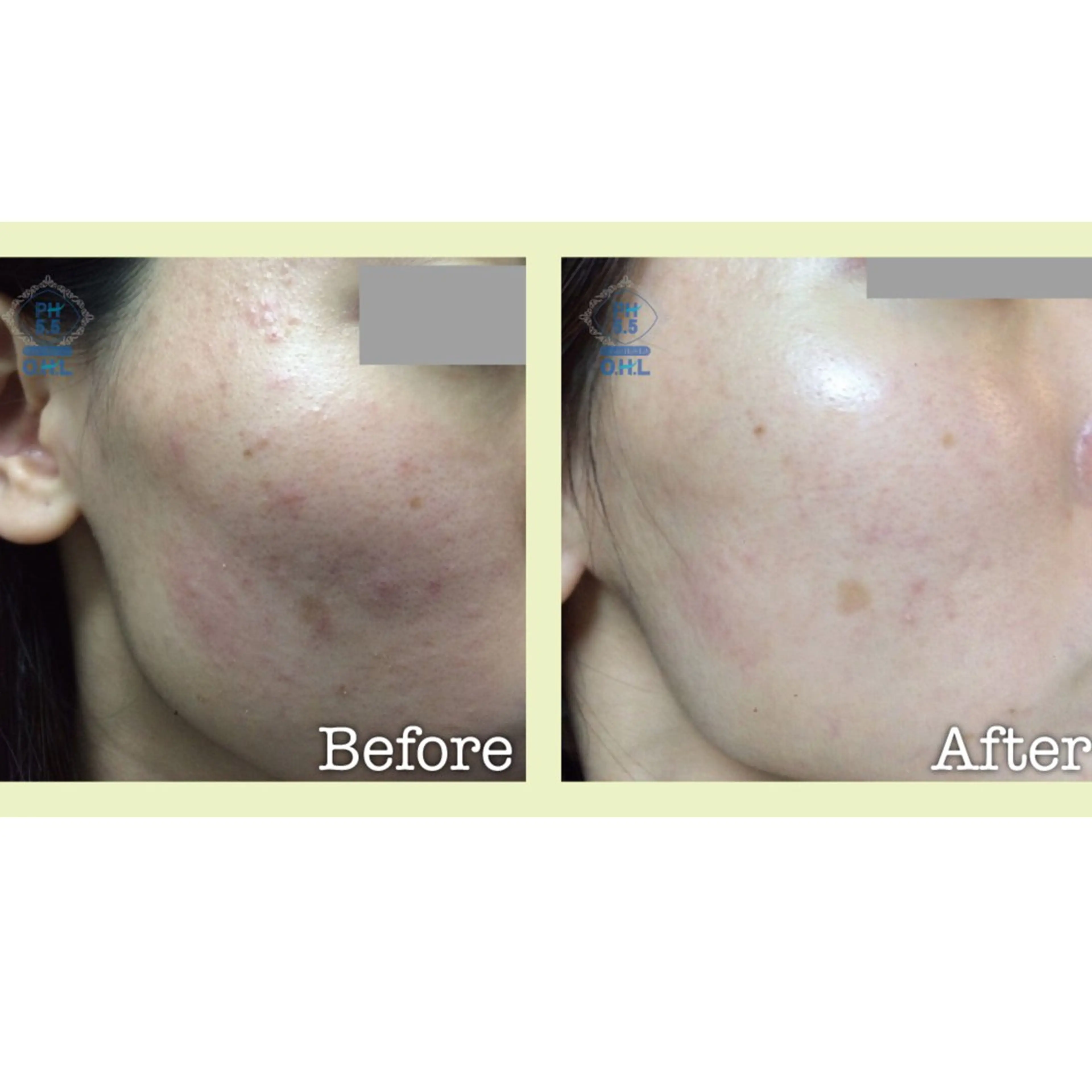 小顔コルギSalon de ETULEのエステ・リラクイメージ