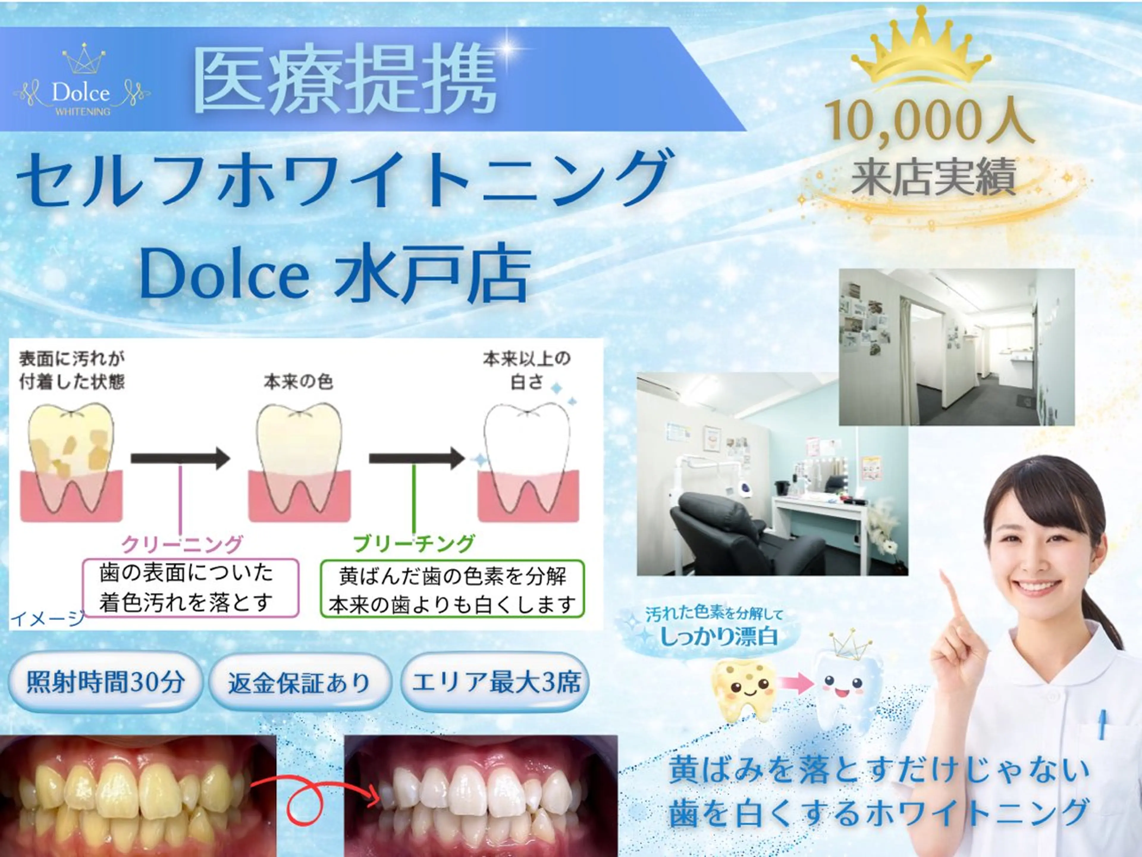 セルフホワイトニング Dolce水戸店のその他イメージ