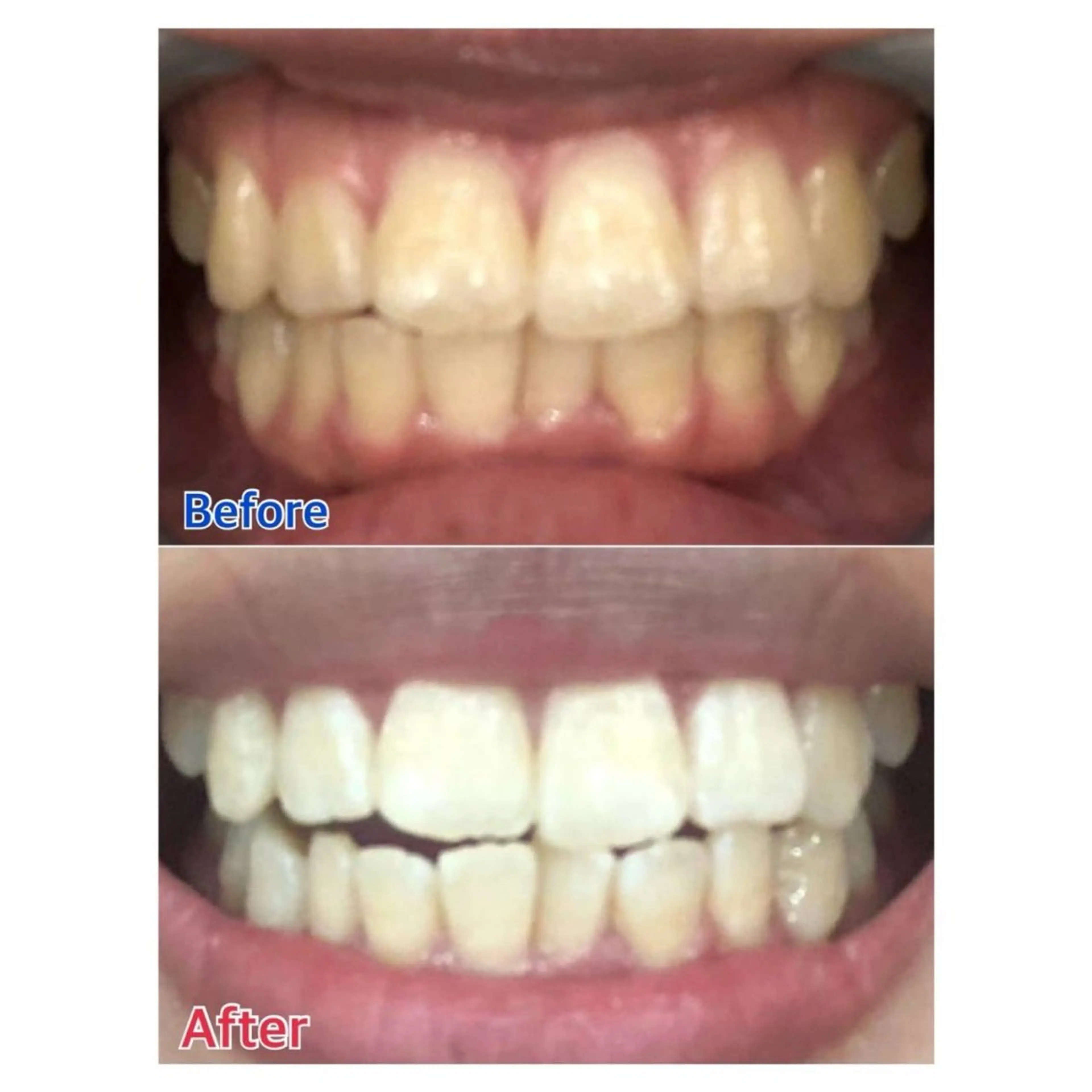 MBEAUTYSALON 千葉店・京成大久保所属・Melty 輝のその他イメージ