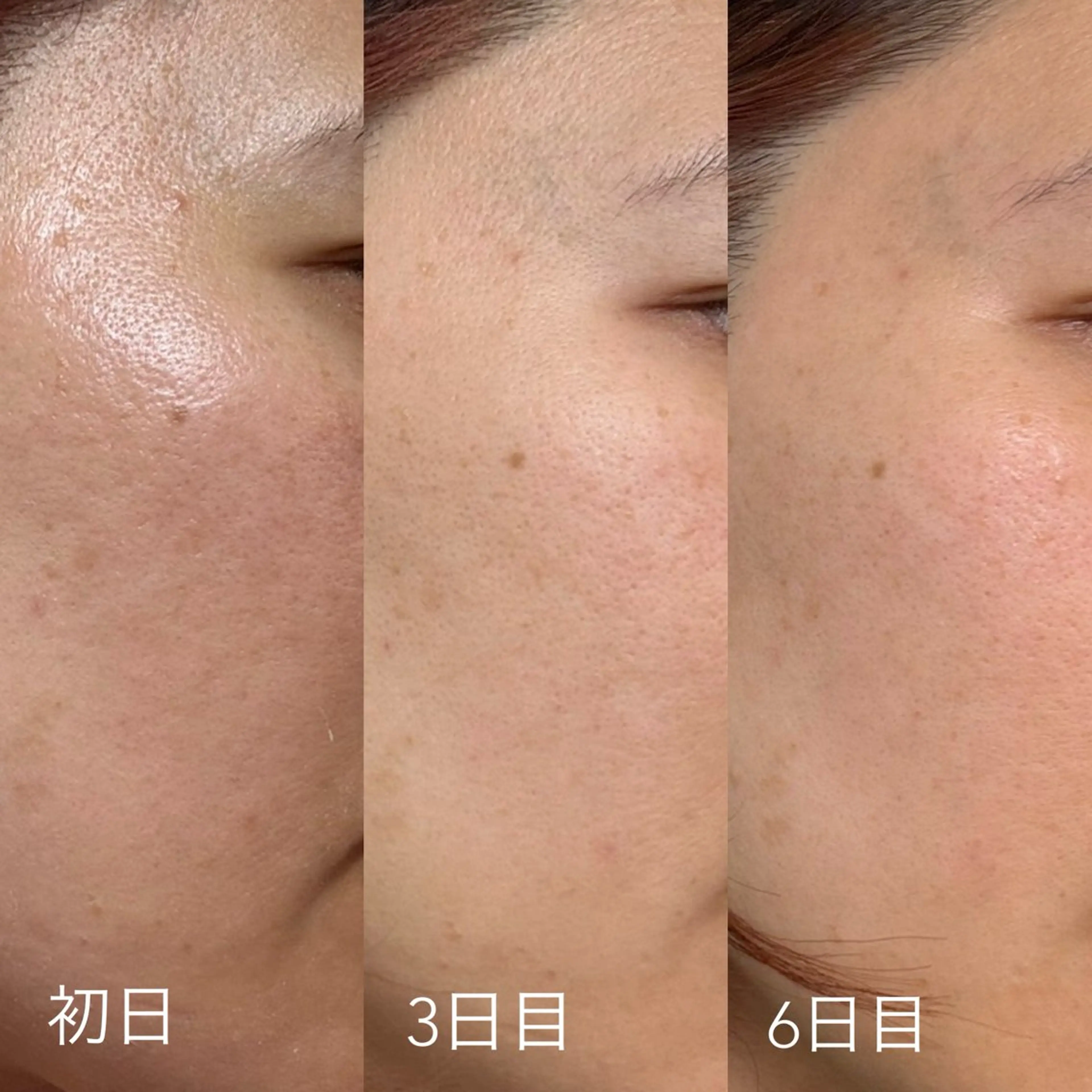 エステティックサロン Liente(リアンテ)所属・Hashimoto .のエステ・リラクイメージ