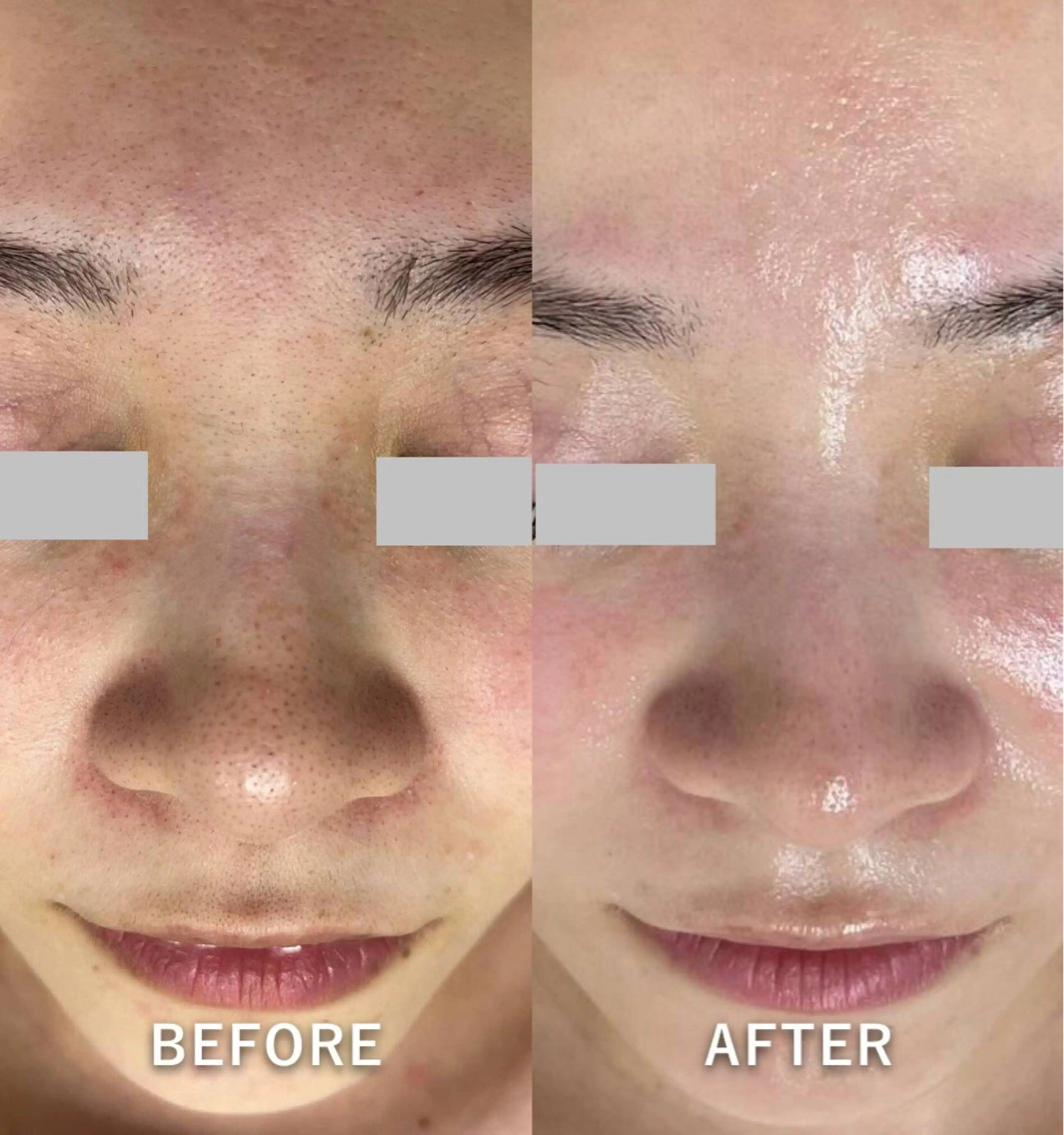 韓国美肌/肌質改善 【天神】yuiのエステ・リラクイメージ